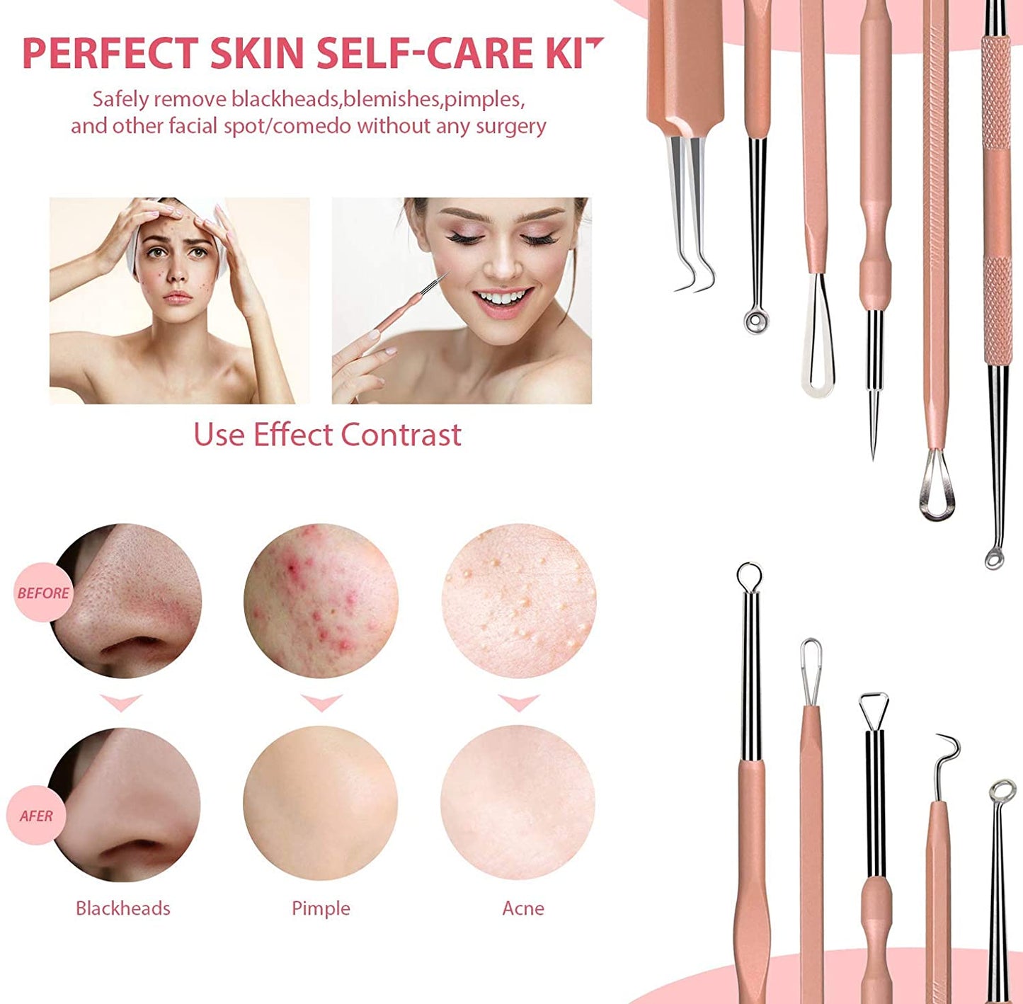 JPNK NEW Pink Blackhead Remover Tools Comedone Extractor Acne Removal Kit for Blemish, Whitehead Popping, Zit Removing for Nose Face with Leather Bag Health & Beauty > Personal Care > Cosmetics > Cosmetic Tools > Skin Care Tools JPNK
