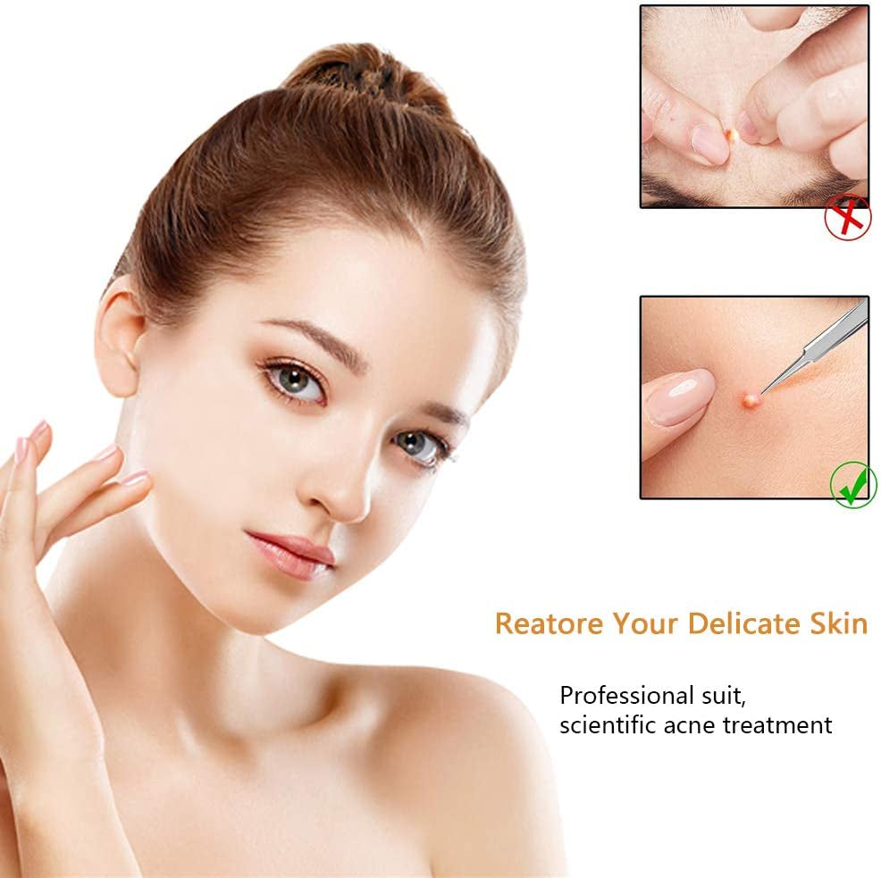 Pimple Popper Tool Kit Blackhead Tweezer, Aooeou Acne Removal Comedone Extractor Kit Pimple Tweezers for Pimples, Blackheads, Blemish, Whitehead, Zit Removing for Forehead Nose Facial Pore Health & Beauty > Personal Care > Cosmetics > Cosmetic Tools > Skin Care Tools Aooeou