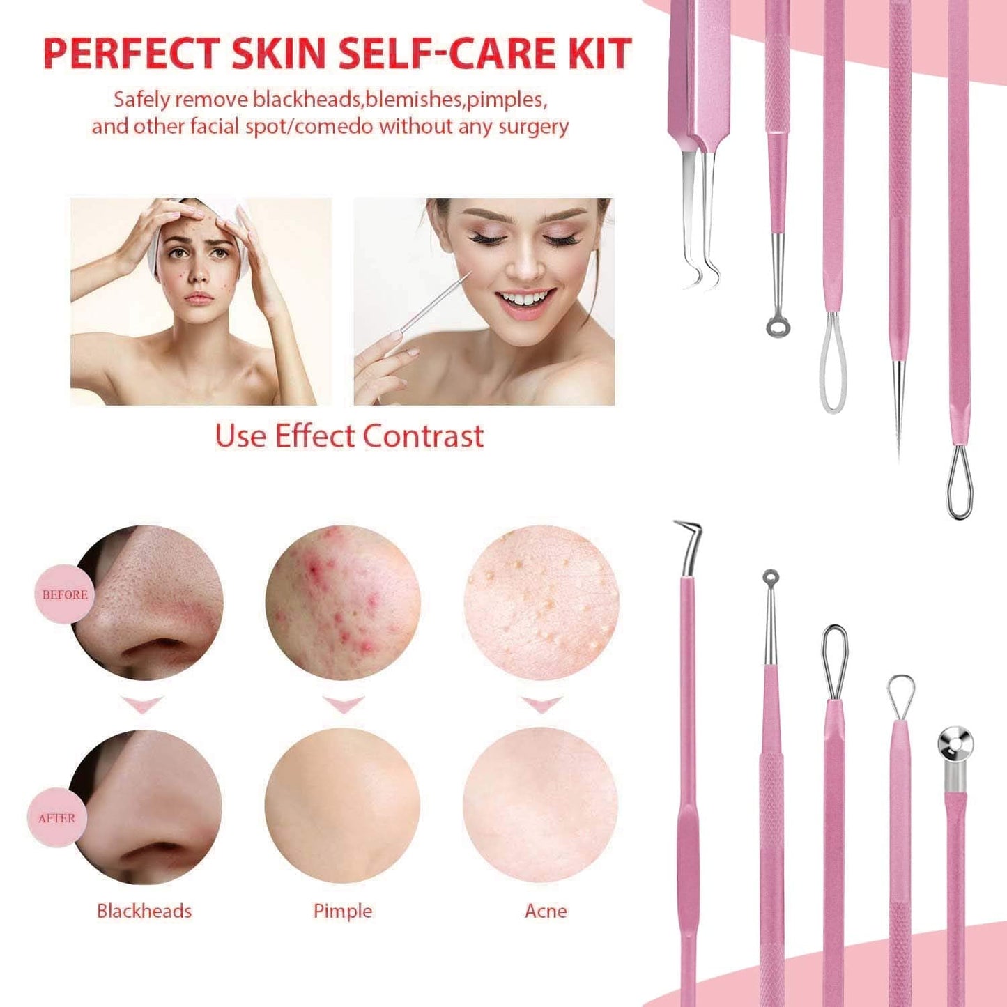 10PCS Blackhead Remover Tool, Aooeou Professional Pimple Popper Tool Kit - Treatment for Blemish, Whitehead Popping, Zit Removing for Risk Free Nose Face, Anti-Slip Coating Handle(Pink) Health & Beauty > Personal Care > Cosmetics > Cosmetic Tools > Skin Care Tools Aooeou