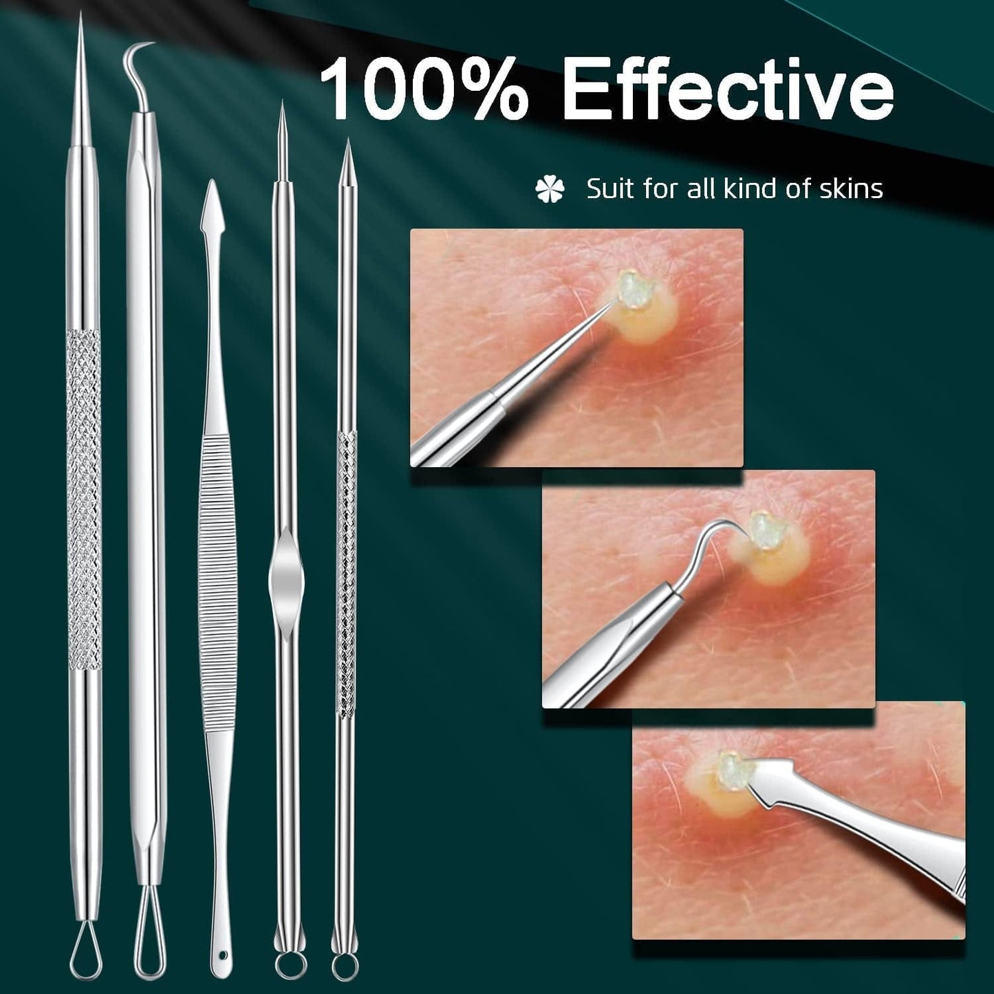 22PCS Blackhead Remover Tools, Acne Blemish Removal, Pimple Popper Extractor, Comedone Whitehead Zit Tweezers, Stainless Steel with Metal Case Health & Beauty > Personal Care > Cosmetics > Cosmetic Tools > Skin Care Tools THEDEFOL