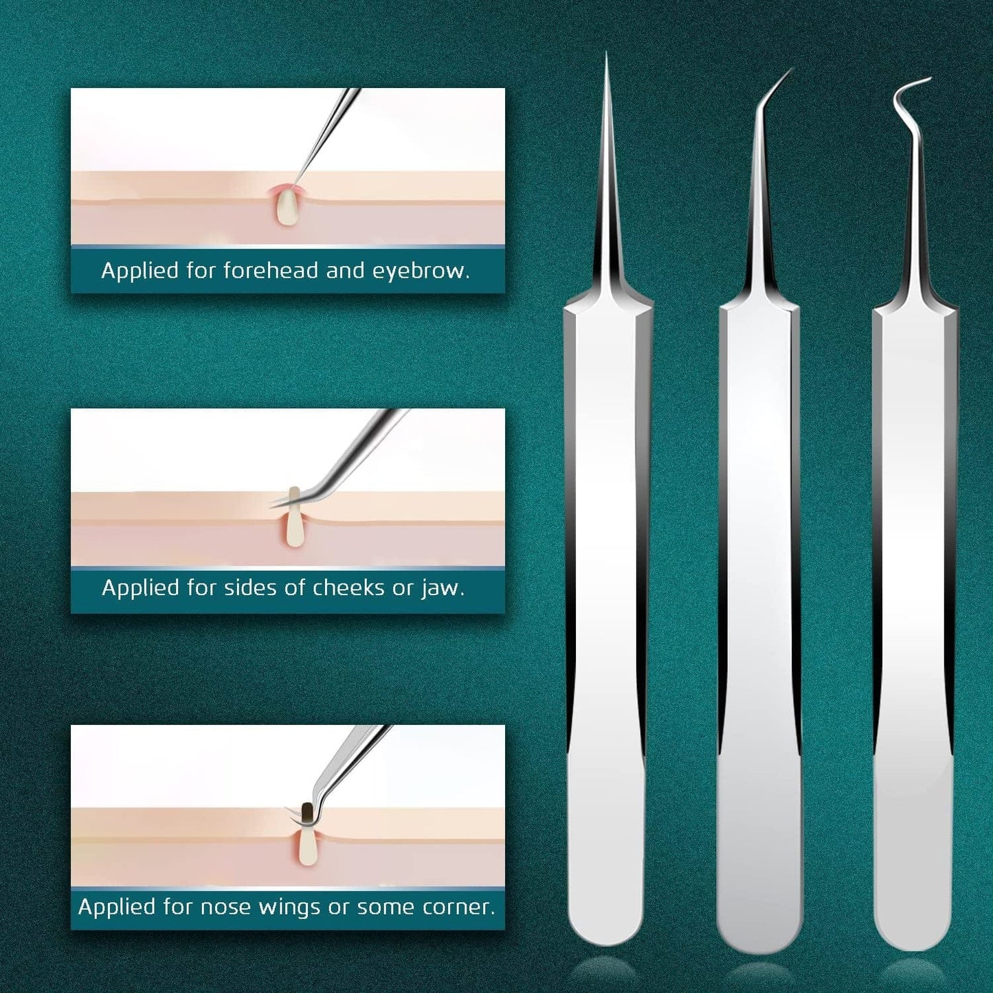 22PCS Blackhead Remover Tools, Acne Blemish Removal, Pimple Popper Extractor, Comedone Whitehead Zit Tweezers, Stainless Steel with Metal Case Health & Beauty > Personal Care > Cosmetics > Cosmetic Tools > Skin Care Tools THEDEFOL
