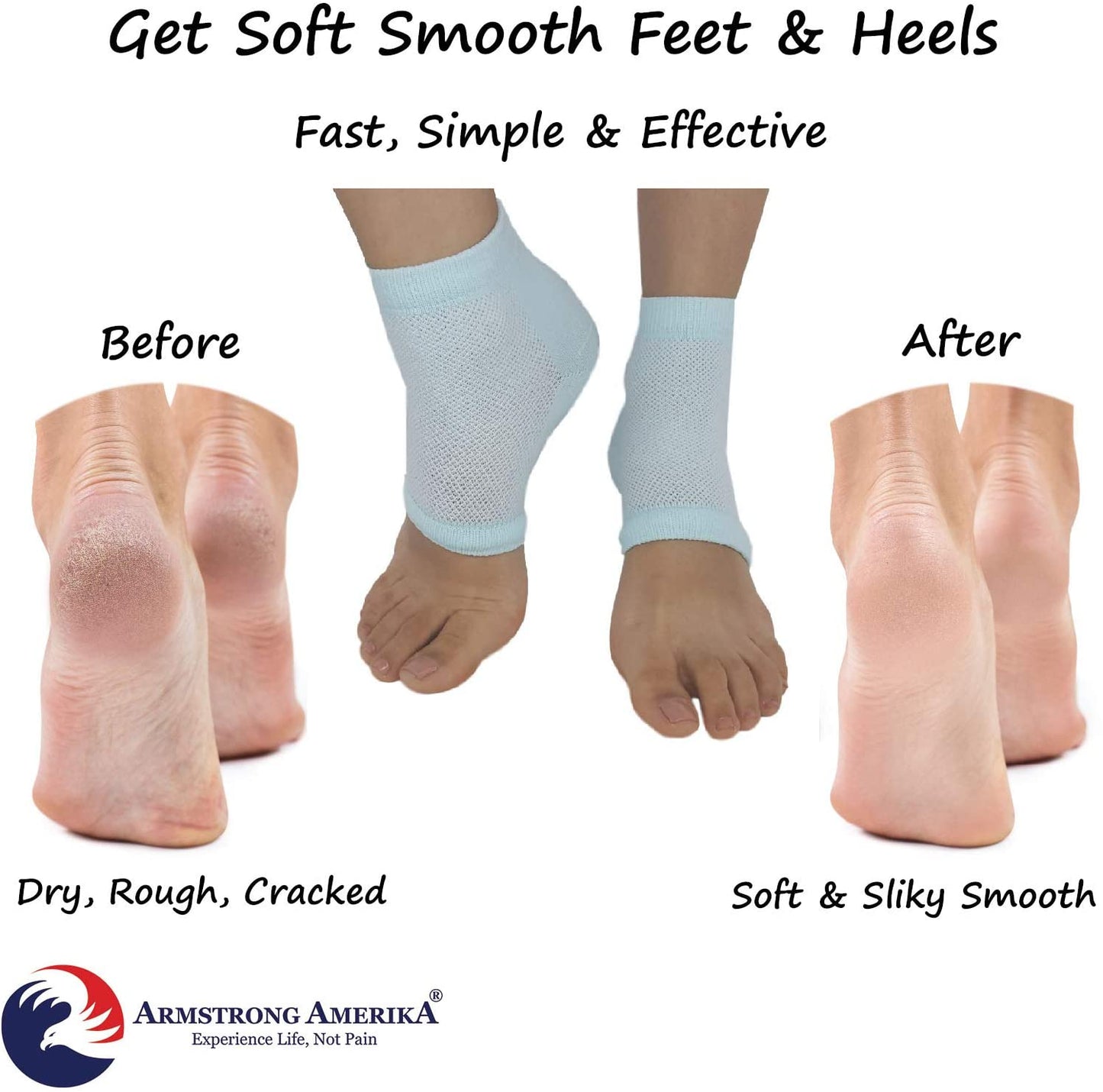 Moisturizing Socks for Cracked Heel Repair - Dry Heels Treatment for Rough Feet, Toeless Aloe Lotion Moisturizer Silicone Gel Lined Moisture Spa Heel Socks Pedicure Foot Care for Women Men Fits Most Health & Beauty > Personal Care > Foot Care ARMSTRONG AMERIKA