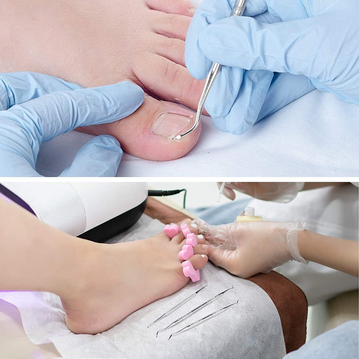 3-Pack Ingrown Toenail File and Lifters, Professional Surgical Stainless Steel Ingrown Toenail Tool- Safe Nail Cleaning Treatment Pedicure Tools Kit under Sidewall Cleaner Pain Relief Accessories Health & Beauty > Personal Care > Cosmetics > Cosmetic Tools > Nail Tools POLKASTORE
