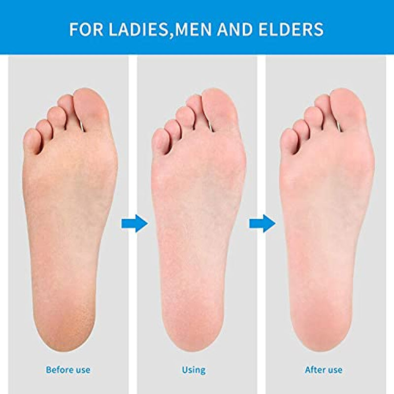 Dr.Nail Callus Remover for Feet Professional Colossal Foot Rasp and Stainless Steel Foot Flie Scrubber Pedicure Tool to Foot Care Remove Hard Skin Can Be Used to Wet and Dry Feet (Large) Health & Beauty > Personal Care > Foot Care Dr.nail