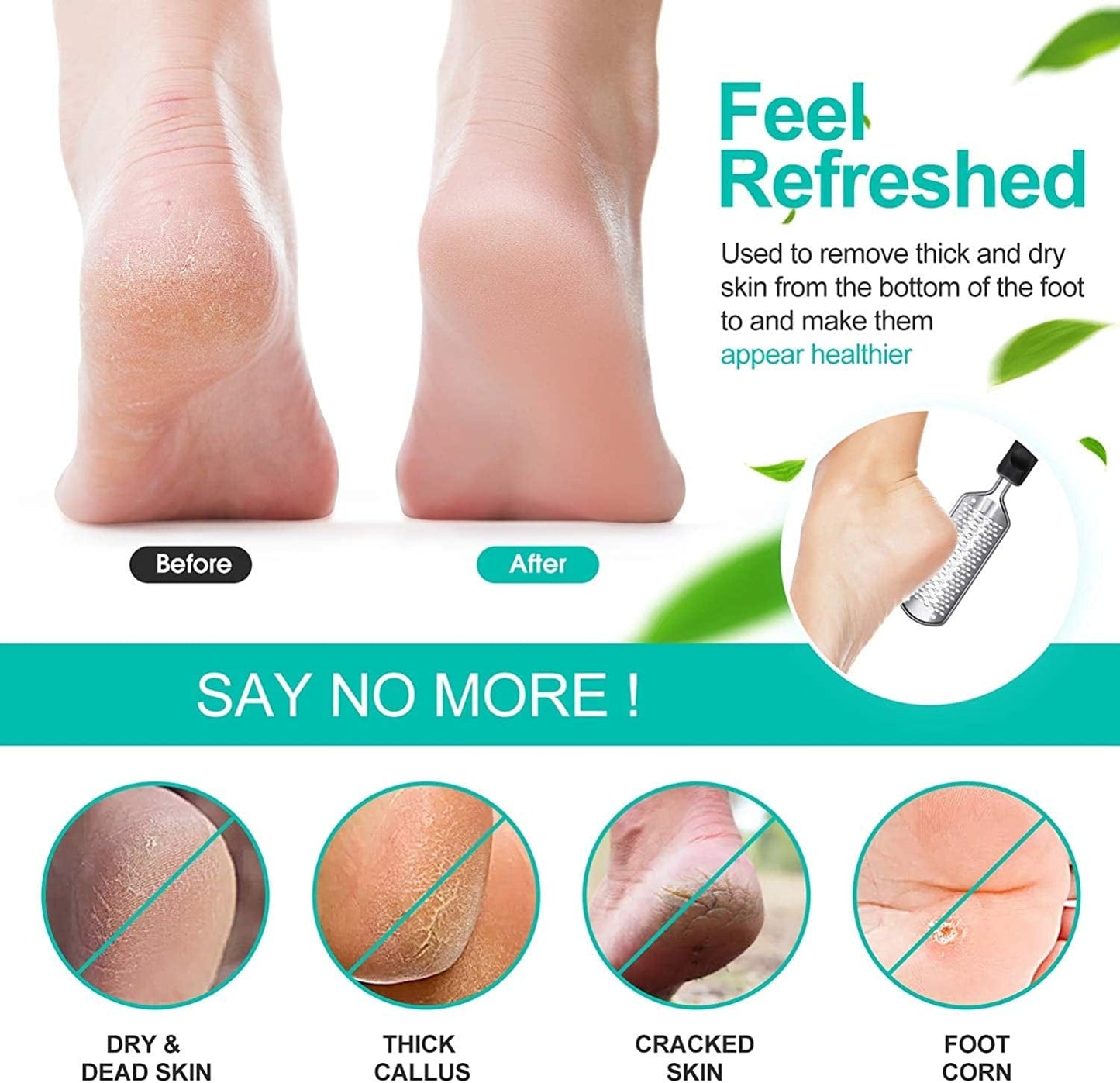 3Pcs Foot Files for Pedicures, 2 Stainless Steel Foot File Graters with an Extra Strong Removable Frame and a 2 Sided Foot File. Great Foot Care Products to Make Your Feet Look Healthy &Feel Refreshed Health & Beauty > Personal Care > Foot Care Capspace