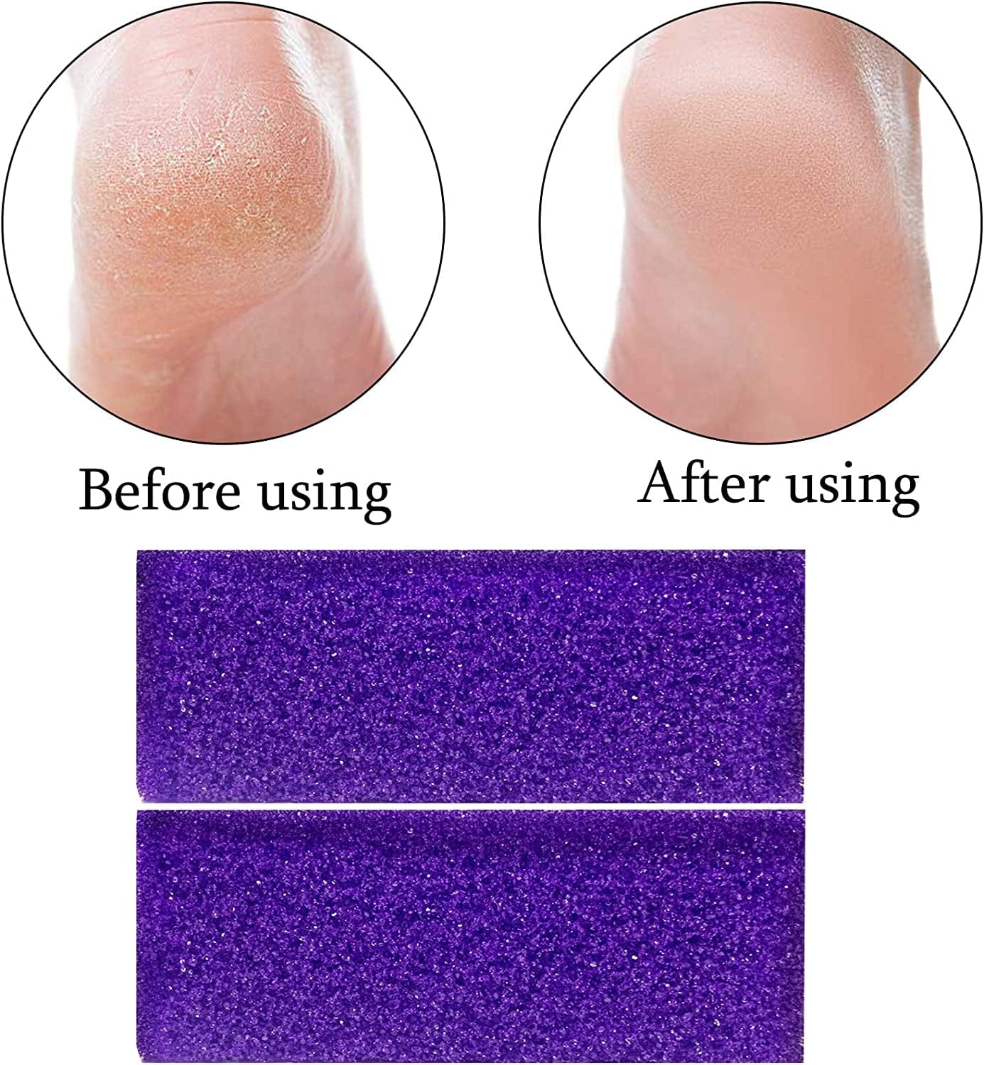 40 Pcs Pumice Stone for Feet Foot Scrubber Sponge for Feet Care and Callus Remover Mini Disposable Pumice Pads for Dead Skin Remover (Purple) Health & Beauty > Personal Care > Foot Care Tailpa