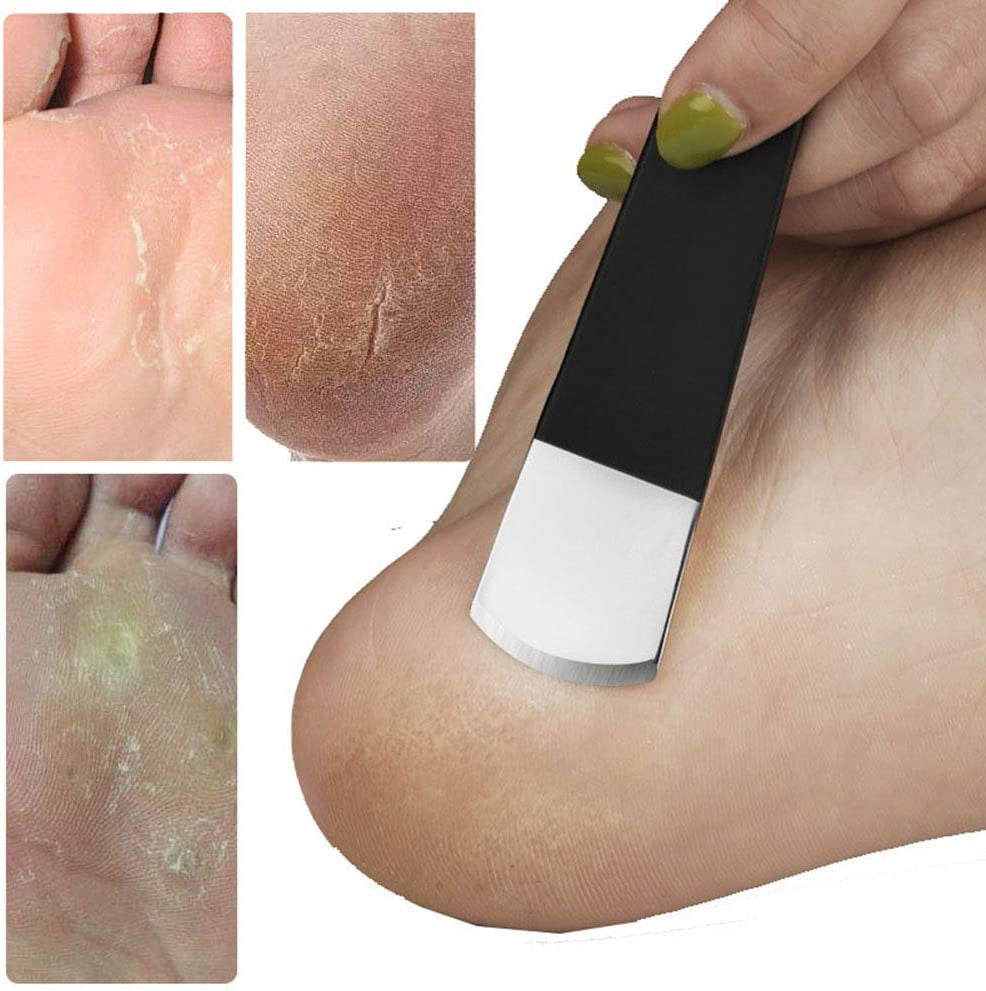 Foot Care Pedicure Callus Shaver Hard Skin Remover 10 Blades Ingrown Toenail Tools Kit, Ingrown Toenail Removal Correction Clippers, Professional Pedicure Tools (Black)… Health & Beauty > Personal Care > Foot Care ATTENDRE