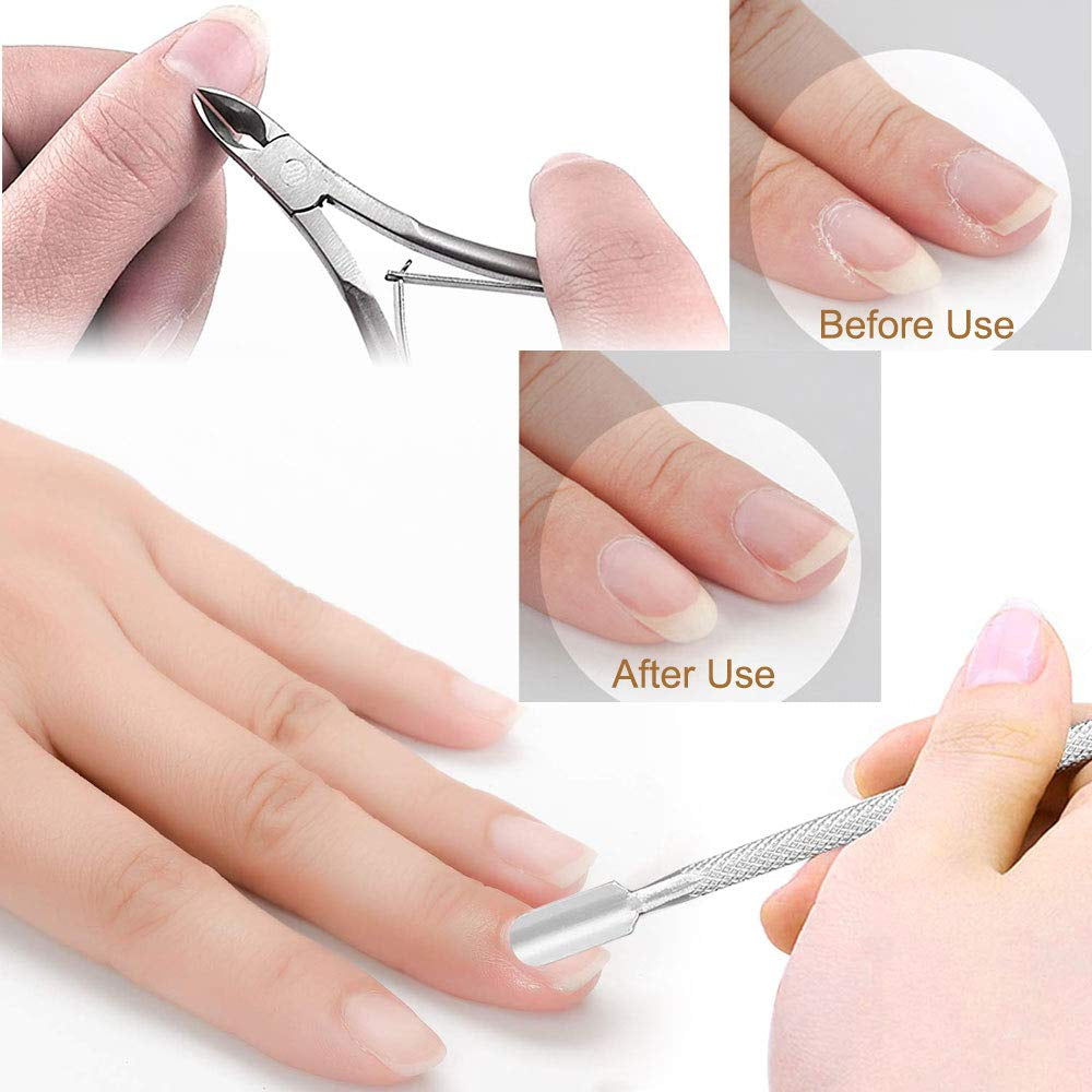 Linkhood Professional Pedicure Tools Set(20 in 1), Foot Care Pedicure Kit Stainless Steel Foot Rasp Foot Dead Skin Remover Pedicure Kit for Men Women Mother’S Day Gift Health & Beauty > Personal Care > Foot Care Linkhood