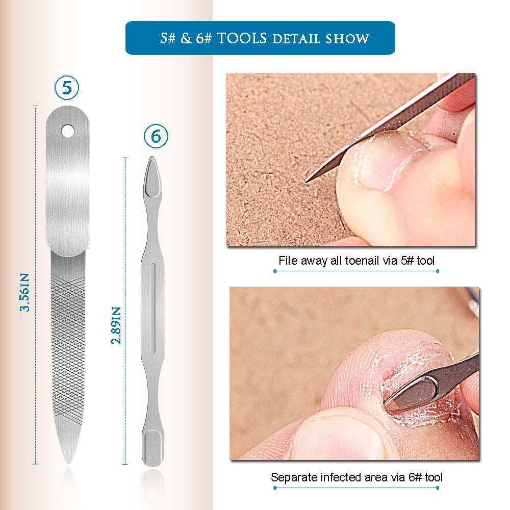 Premium 6PCS Ingrown Toenail Tools, Nail File and Lifter, Foot Nail Treatment Tool, Toe Nail Removal Clippers, Upgraded Stainless Steel, Professional Pedicure Tools, with Nail Cutter Trimmer Health & Beauty > Personal Care > Cosmetics > Cosmetic Tools > Nail Tools USCOLOR