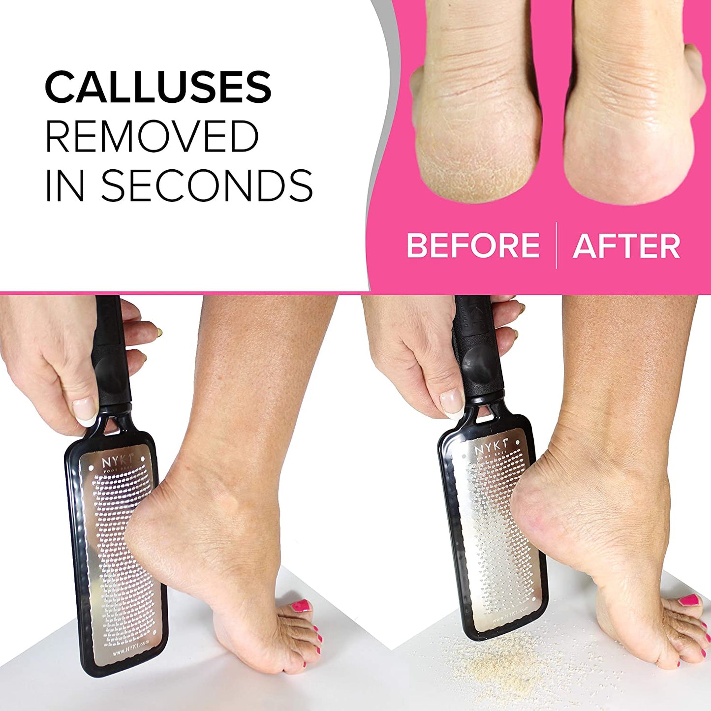 Pedicure Rasp for Dry Hard Skin - BEST SELLING Foot File GENUINE MEGAFILE Heel Care Callus Remover Dry Dead Skin Egg Corn Sander Scrubber Pumice Stone Alternative Ped Pedi Grater Files Add on Item Health & Beauty > Personal Care > Foot Care NYK1