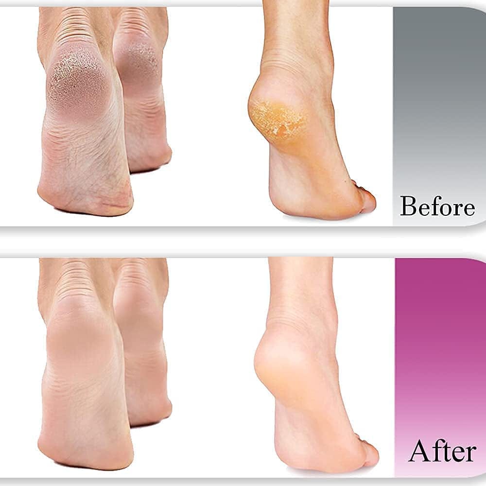 Amble Foot File, Nanomaterials Foot Rasp and Callus Remover - Professional Foot Care Pedicure Foot Scrubber Tool to Remove Cracked Heels, Mother'S Day Gift, Dead Skin, Hard Skin… Health & Beauty > Personal Care > Foot Care Amble