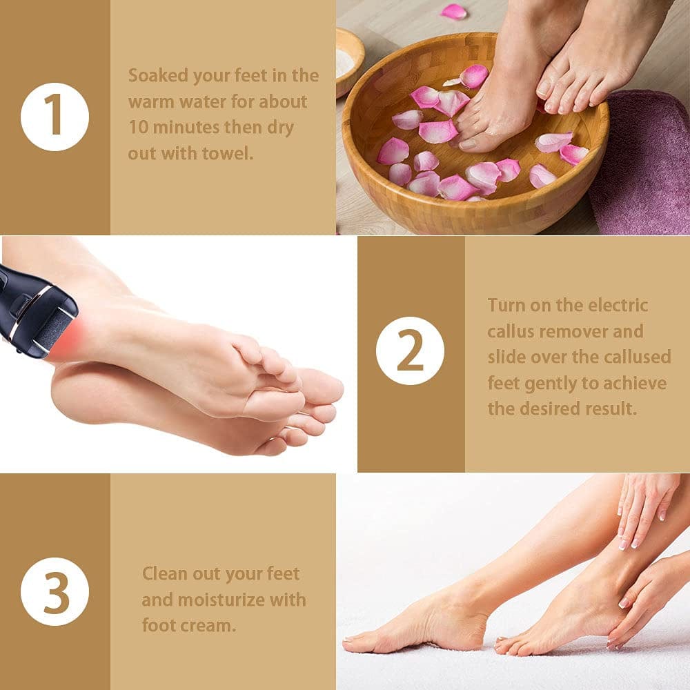 Aottom Foot Callus Remover - Electric Pedicure Tools Foot Care Feet File with 3 Roller Heads 2 Speed Battery Display for Remove Cracked Heels Calluses Dead Skin - Black Health & Beauty > Personal Care > Foot Care Aottom