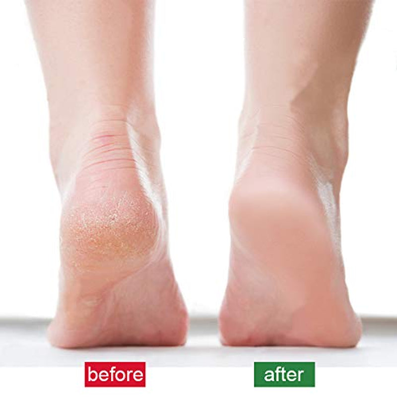 Rolencos Peppermint Cooling Moisturizing Foot Cream 4.20Oz, Callus Remover, Thick, Cracked, Rough, Dead and Dry, Hard Feet, Heels, Soles, Professional Crack Foot Care Rescue Cream Health & Beauty > Personal Care > Foot Care rolencos