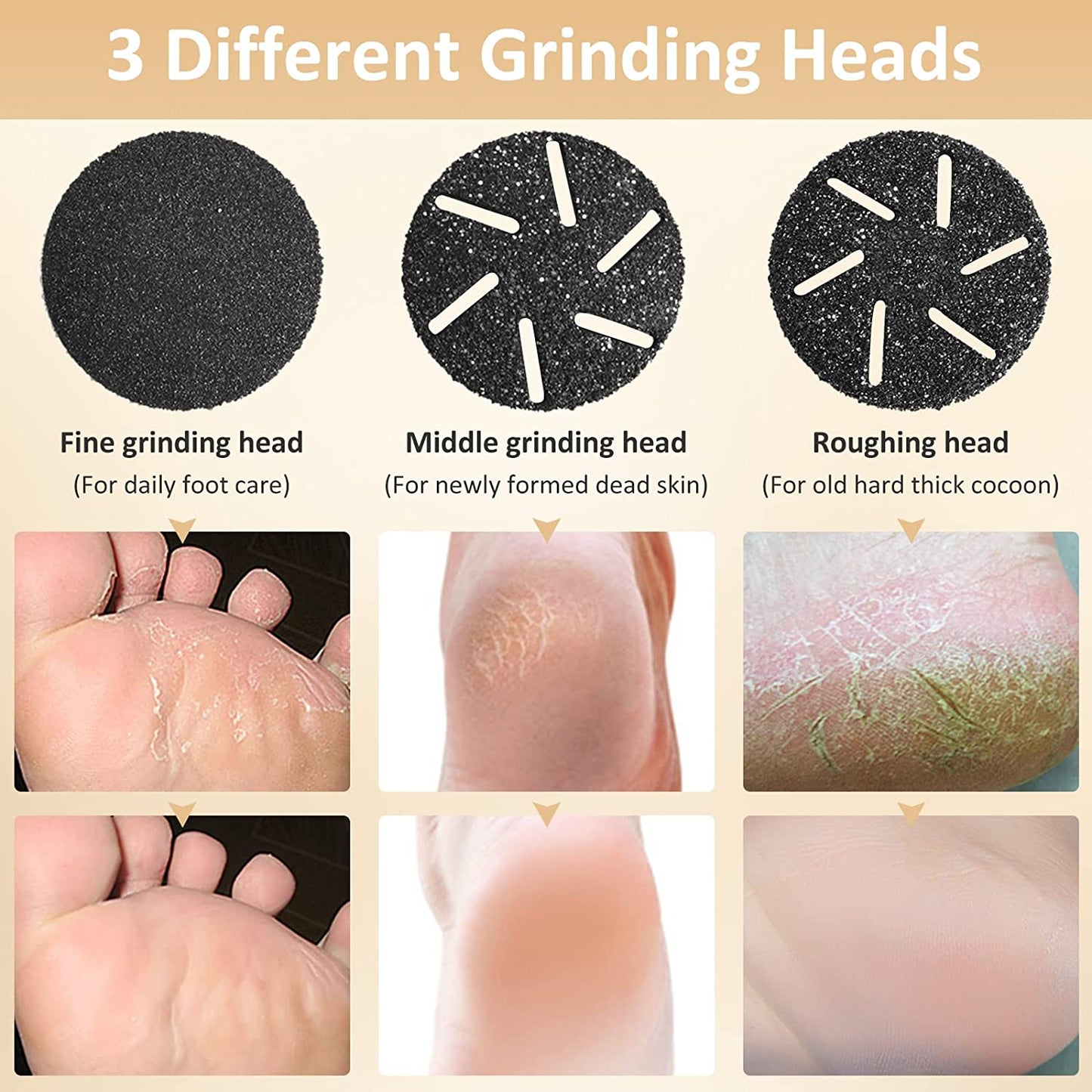 Electric Callus Remover for Feet, Ms.Belles Rechargeable Foot Care Scraper Pedicure Tools with 3 Grinding Heads, 2 Powerful Speed, LCD Display, Waterproof Foot File for Hard Cracked Dry Dead Skin Health & Beauty > Personal Care > Foot Care Ms.Belles