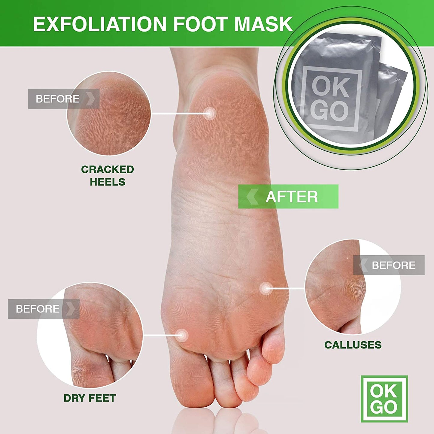 Exfoliating Foot Peel Mask 2 Pack - Baby Feet Peeling Mask for Dead Skin - Remove Calluses, Cracked Heels Repair Dry Toe Skin - Baby Soft Feet Gel Socks - Natural Foot Care Treatment with Aloe Vera Health & Beauty > Personal Care > Foot Care OK Goods