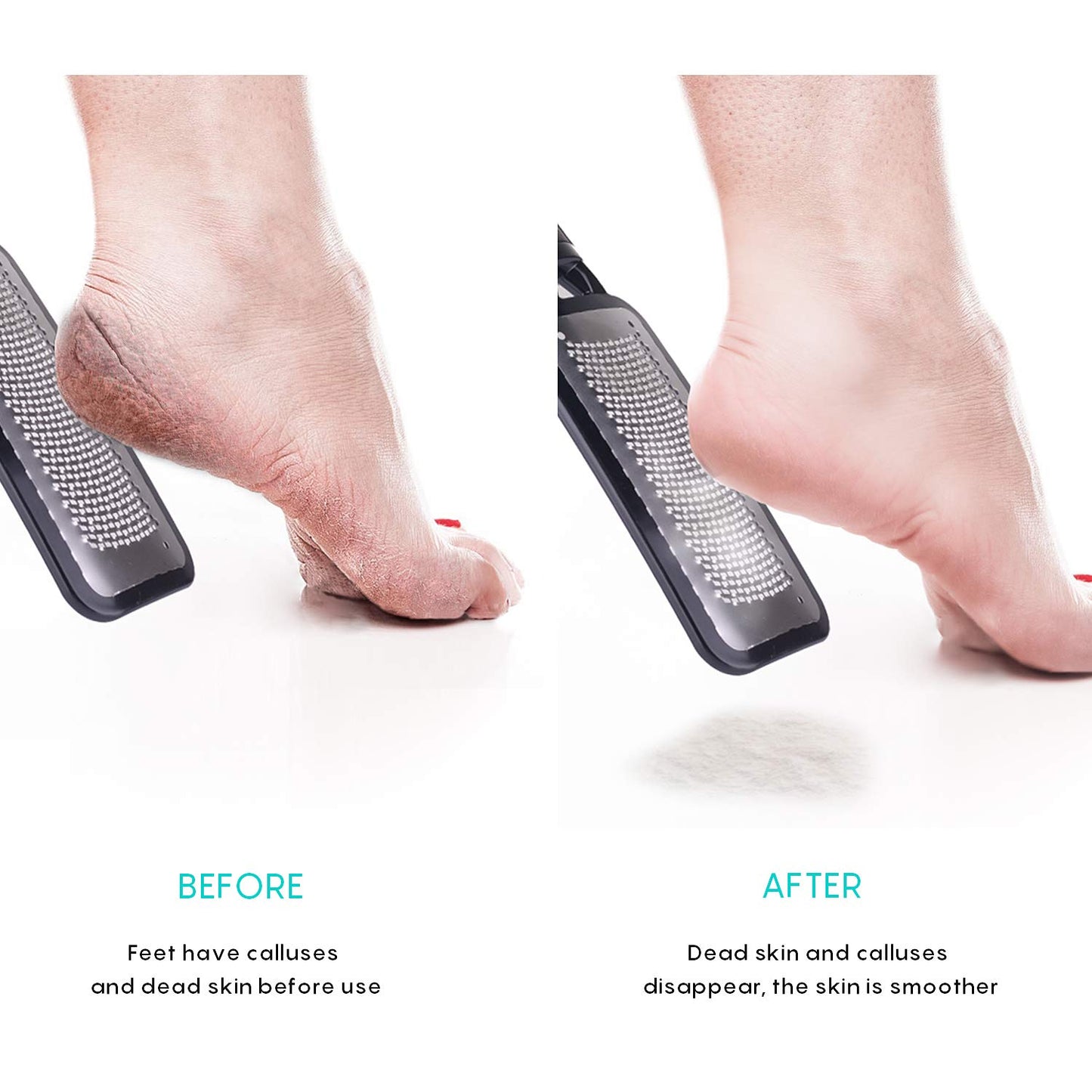 Feet Scrubber Dead Skin 5 Pack - KENED Foot File Callus Remover for Feet, Professional Pedicure Kit with 2 X Metal Foot Grater, 3 X White Double-Sided Pedicure Tools for Feet Care Health & Beauty > Personal Care > Foot Care KENED