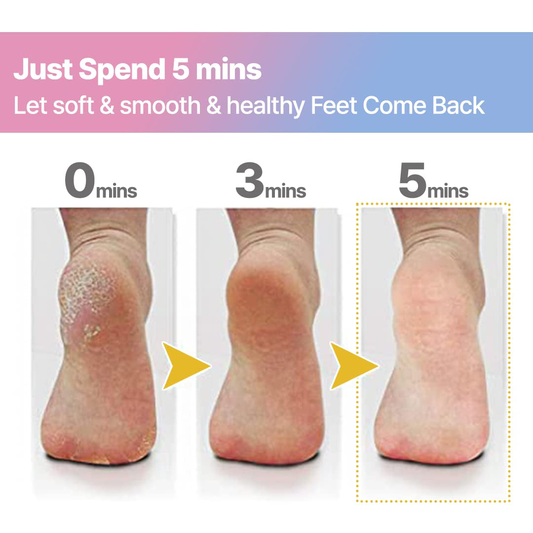 Colossal Innovative Nano Glass Callus Remover Foot File - Coarse Foot Rasp Colossal Foot Scrubber Salon Home Pedicure Foot Care Tool for Soft Feet (1PC) Health & Beauty > Personal Care > Foot Care SUMI ECO ECO-FRIENDLY