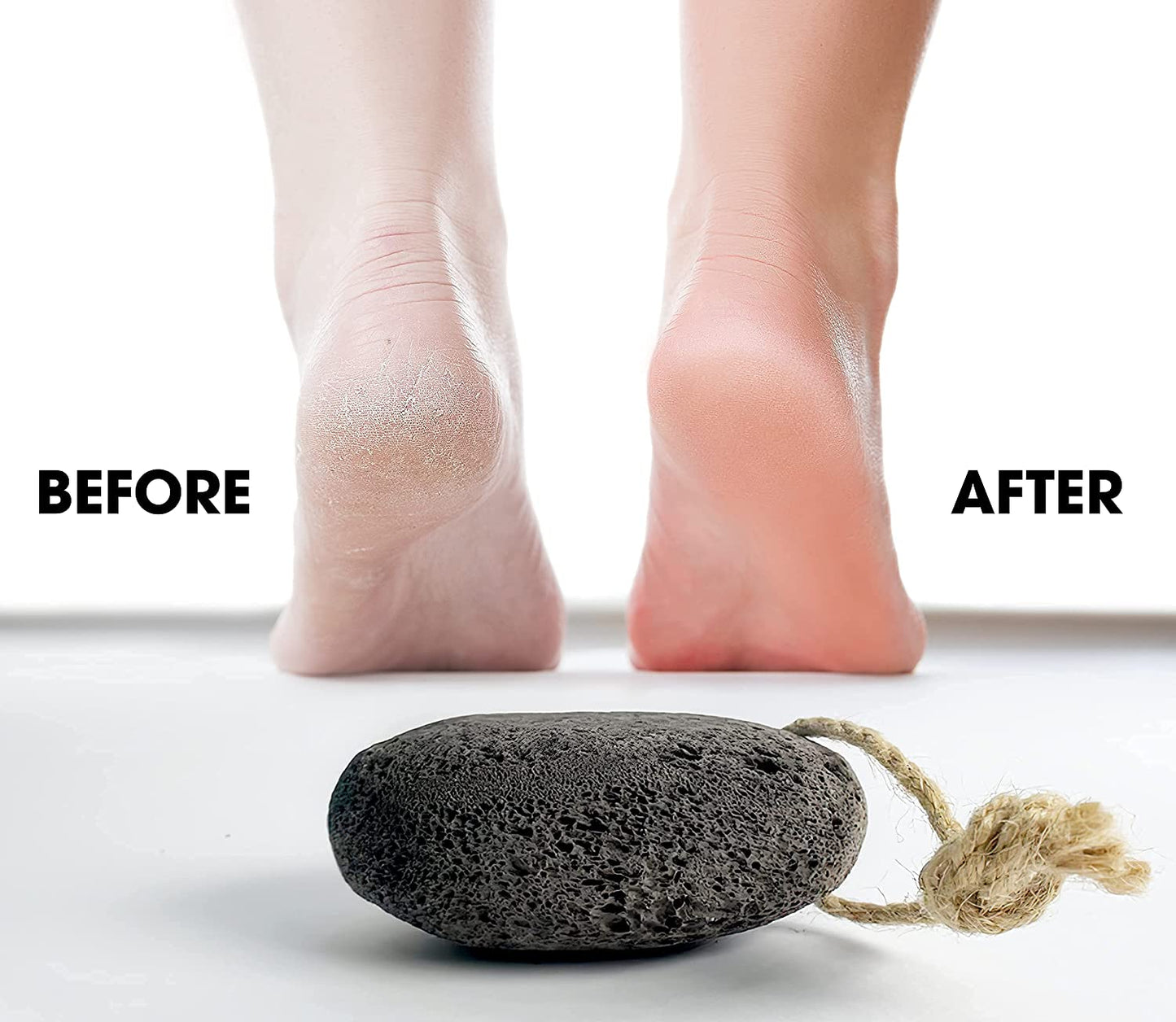 Foot Pumice Stone by VNI Stone - Natural Earth Lava Pumice Stone for Feet Callus Removal- Callus Warts Corn Removal - Pedicure Exfoliator for Dry Dead Skin, Heels, Palm - Healthy Foot Care Scrubber Health & Beauty > Personal Care > Foot Care VNI Stone