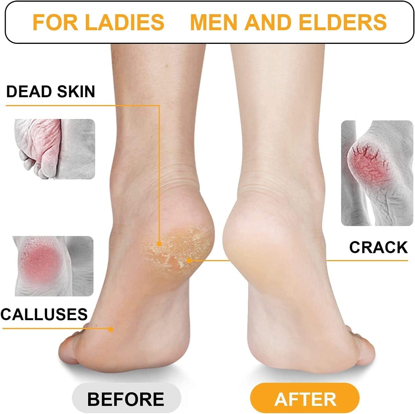 Zeeva Chrome Plated Glass Foot File, Foot Care Pedicure Tool, Hard Skin Cuticle Remover Scrubber, Great for Dead Skin Removal, Cracking, Used on Both Wet and Dry Feet Health & Beauty > Personal Care > Foot Care Zeeva