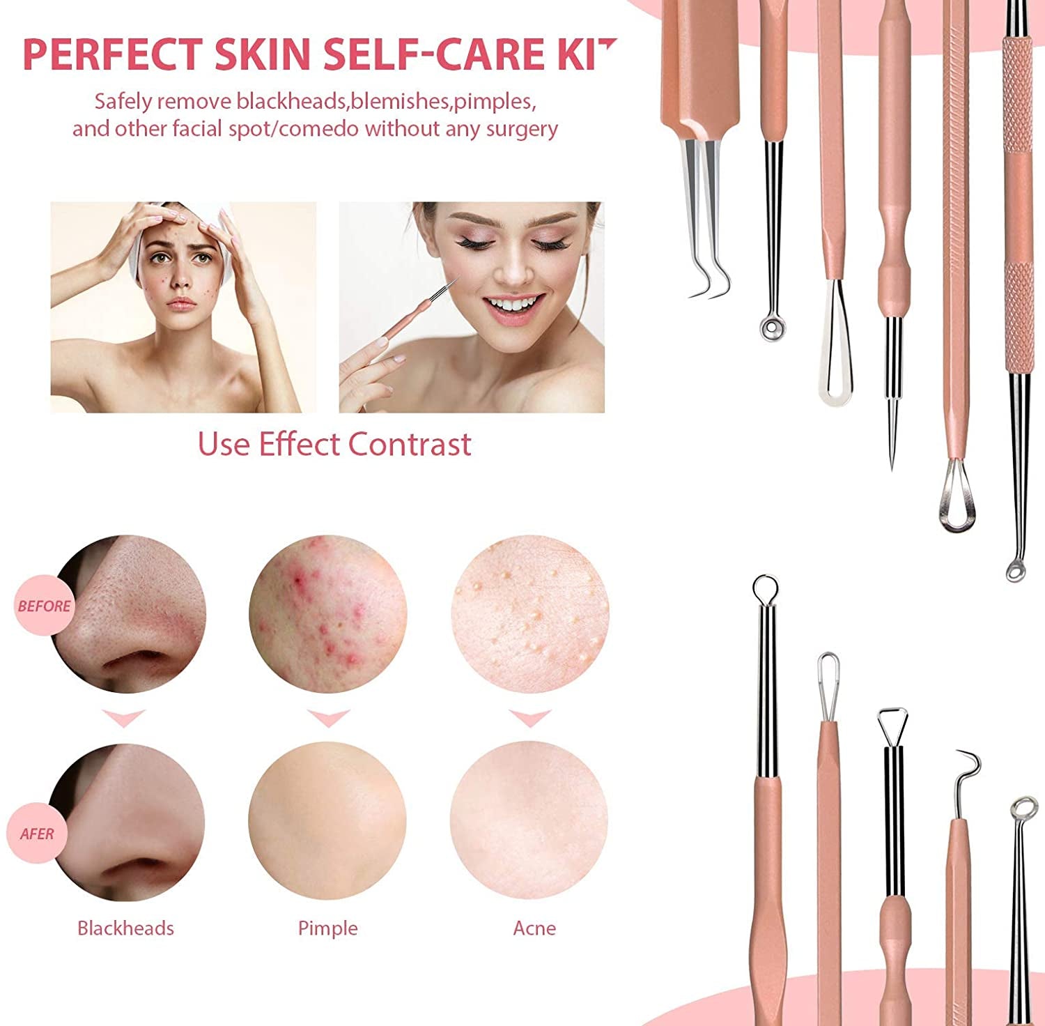 JPNK NEW Pink Blackhead Remover Tools Comedone Extractor Acne Removal Kit for Blemish, Whitehead Popping, Zit Removing for Nose Face with Leather Bag Health & Beauty > Personal Care > Cosmetics > Cosmetic Tools > Skin Care Tools JPNK   