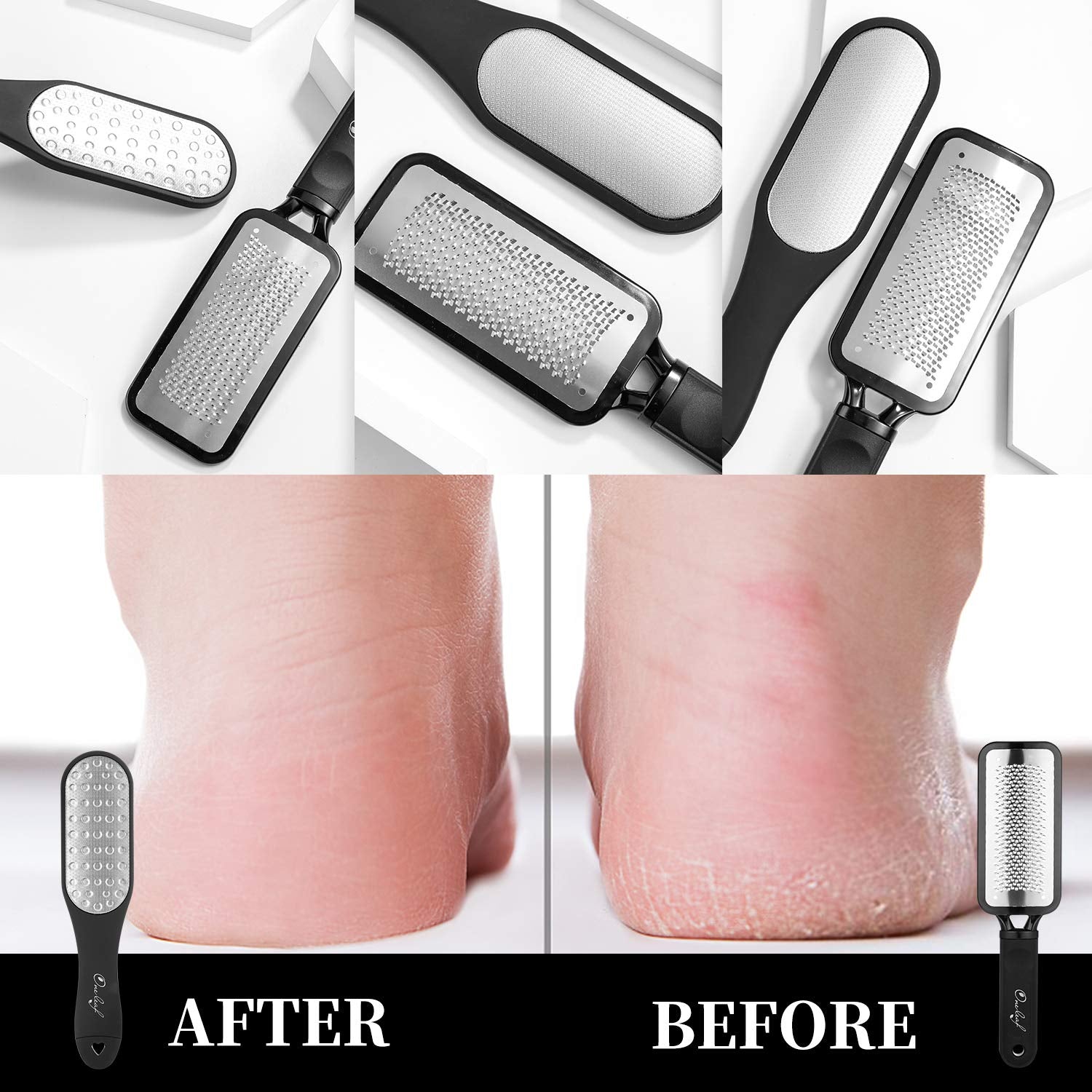 Oneleaf Colossal Pedicure Callus Remover and Double-Sided Foot Rasp Foot File, Foot Care Metal Surface Tool to Remove Hard Skin, for Wet and Dry Feet, Suigical Grade Stainless Steel File… Health & Beauty > Personal Care > Foot Care oneleaf   
