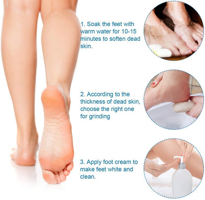 Vridale Pumice Stones for Feet Lava Pumice Stone Foot File Callus Removal Foot Scrubber for Hands Care Foot Exfoliation Dead Skin Remover with Handle Health & Beauty > Personal Care > Foot Care Vridale   