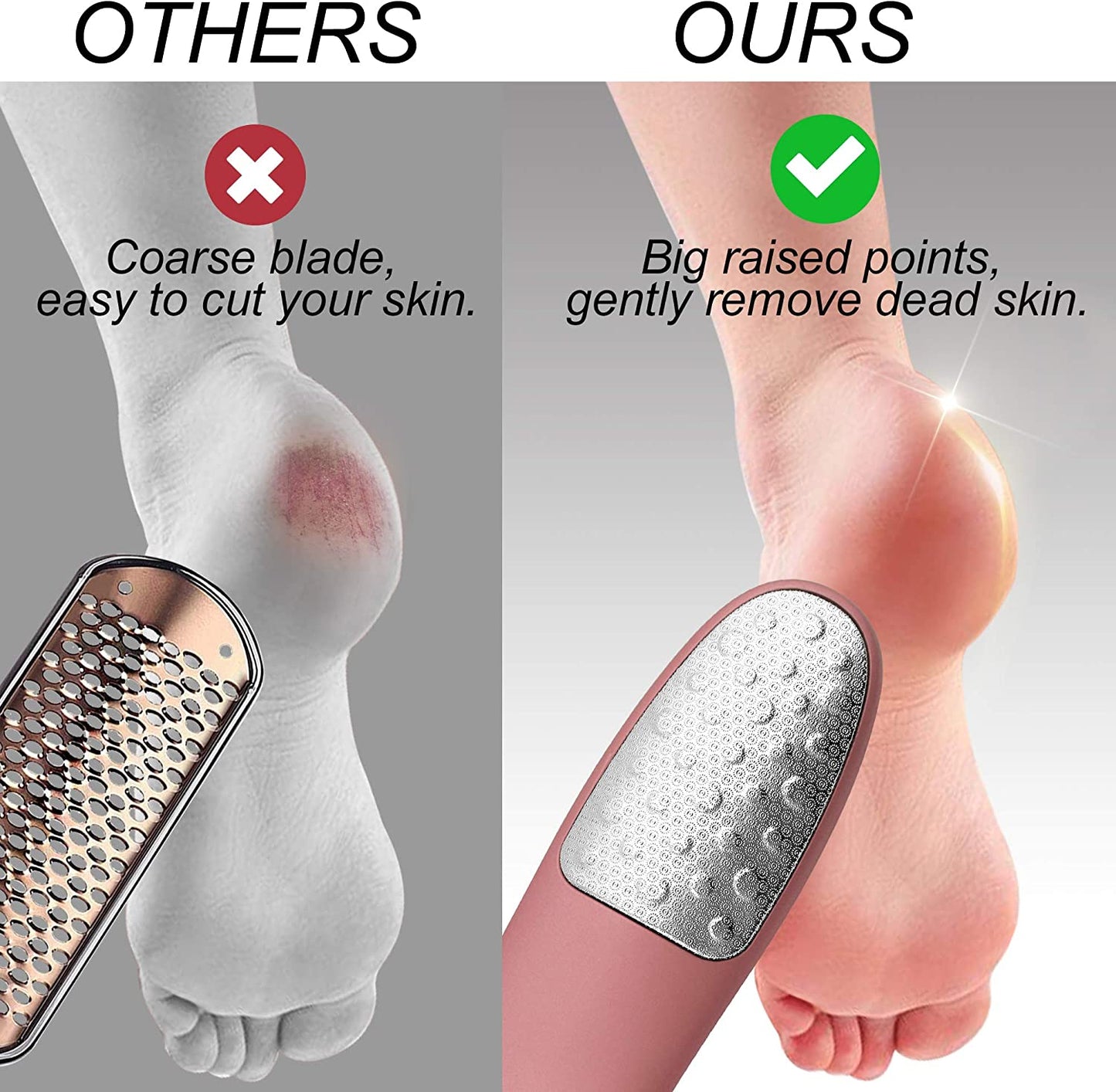 Foot Scrubber with Stand, Never-Cut-Your-Feet Foot File Callus Remover - Safe to Use | Comfortable Foot Scraper Feet Scrubber Dead Skin Remover, Best Home Pedicure Foot Care Tool, Used on Wet/Dry Feet Health & Beauty > Personal Care > Foot Care Weetiee   