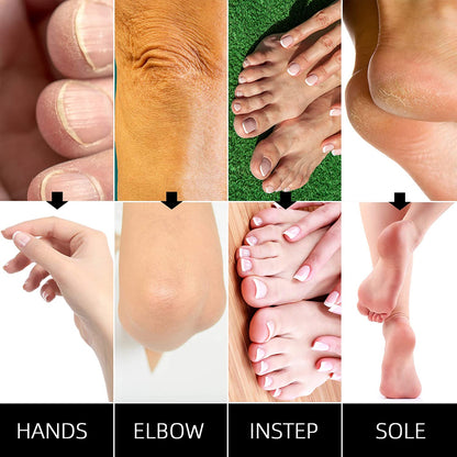Refill Paraffin Wax, SUBUCKOOL Paraffin Bath Bulk 6 Pack, Rose Scented Paraffin Wax Blocks 4 Lbs for Hands & Feet Care, Use to Relieve Arthitis Pain and Stiff Muscles - Deeply Hydrates and Protects Health & Beauty > Personal Care > Foot Care SUBUCKOOL   