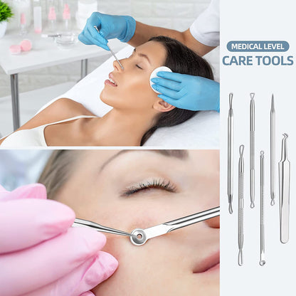 JPNK Blackhead Remover Tool Comedones Extractor Acne Removal Kit for Blemish, Whitehead Popping, 6 Pcs Zit Removing for Nose Face Tools with a Leather Bag Health & Beauty > Personal Care > Cosmetics > Cosmetic Tools > Skin Care Tools JPNK   