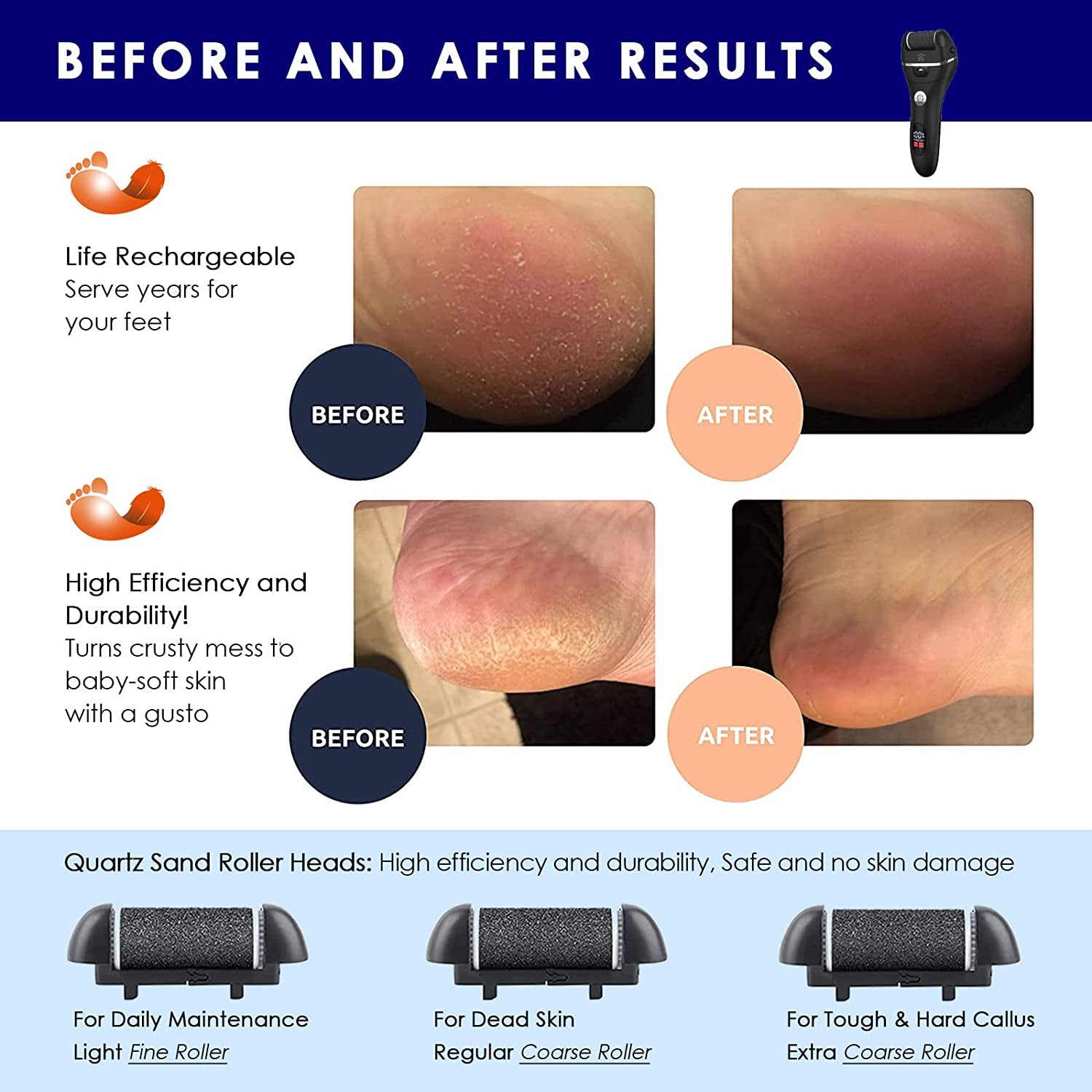 Electric Foot File Callus Remover - IPX7 Waterproof Rechargeable Callus Remover for Feet with 8 in 1 Pedicure Kit Foot Care, 3 Roller Heads, and 2 Speeds Health & Beauty > Personal Care > Foot Care PEFOOK   
