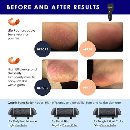 Electric Foot File Callus Remover - IPX7 Waterproof Rechargeable Callus Remover for Feet with 8 in 1 Pedicure Kit Foot Care, 3 Roller Heads, and 2 Speeds Health & Beauty > Personal Care > Foot Care PEFOOK   