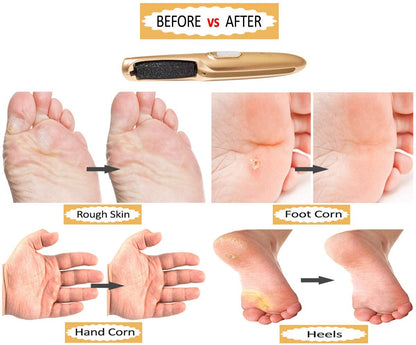 Powerful Electric Foot Callus Removers – Rechargeable Electronic Foot File Removes Dry, Dead, Cracked, Hard Skin & Calluses –Professional Pedicure Foot Care Tool for Men & Women Health & Beauty > Personal Care > Foot Care Care me   