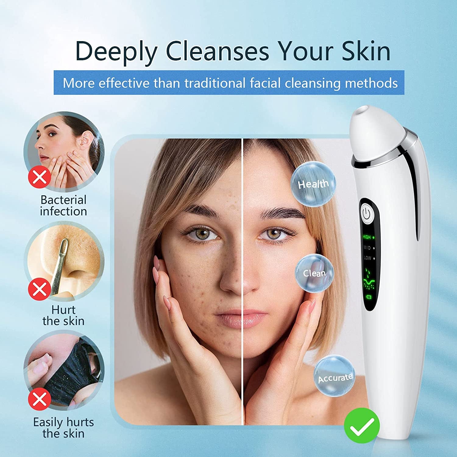 Blackhead Remover Pore Vacuum, Electric Facial Deep Cleaner, USB Rechargeable Male and Female Acne Whitehead Extraction Tool, 6 Suction Heads & 3 Adjustable Suction Health & Beauty > Personal Care > Cosmetics > Cosmetic Tools > Skin Care Tools TTozka   
