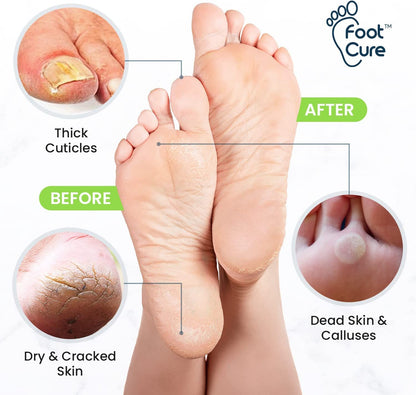 Tea Tree Foot Soak, Callus Remover Gel & Foot File Kit - Extra Strength Callus Remover Gel & Foot Soak with Epsom Salts for Calluses, Dry Cracked Heels, Toenail Fungus & Odor - Pedicure for Tired Feet Health & Beauty > Personal Care > Foot Care FOOT CURE   