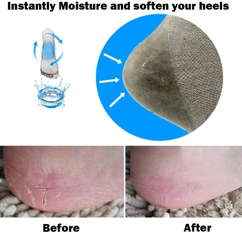 Codream Vented Moisturizing Socks Lotion Gel for Dry Cracked Heels, Spa Gel Socks Humectant Moisturizer Heel Balm Foot Treatment Care Heel Softener Compression 2 Pairs Health & Beauty > Personal Care > Foot Care Codream   