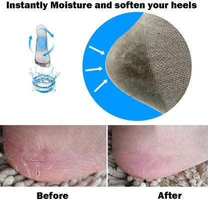 Codream Vented Moisturizing Socks Lotion Gel for Dry Cracked Heels, Spa Gel Socks Humectant Moisturizer Heel Balm Foot Treatment Care Heel Softener Compression 2 Pairs Health & Beauty > Personal Care > Foot Care Codream   