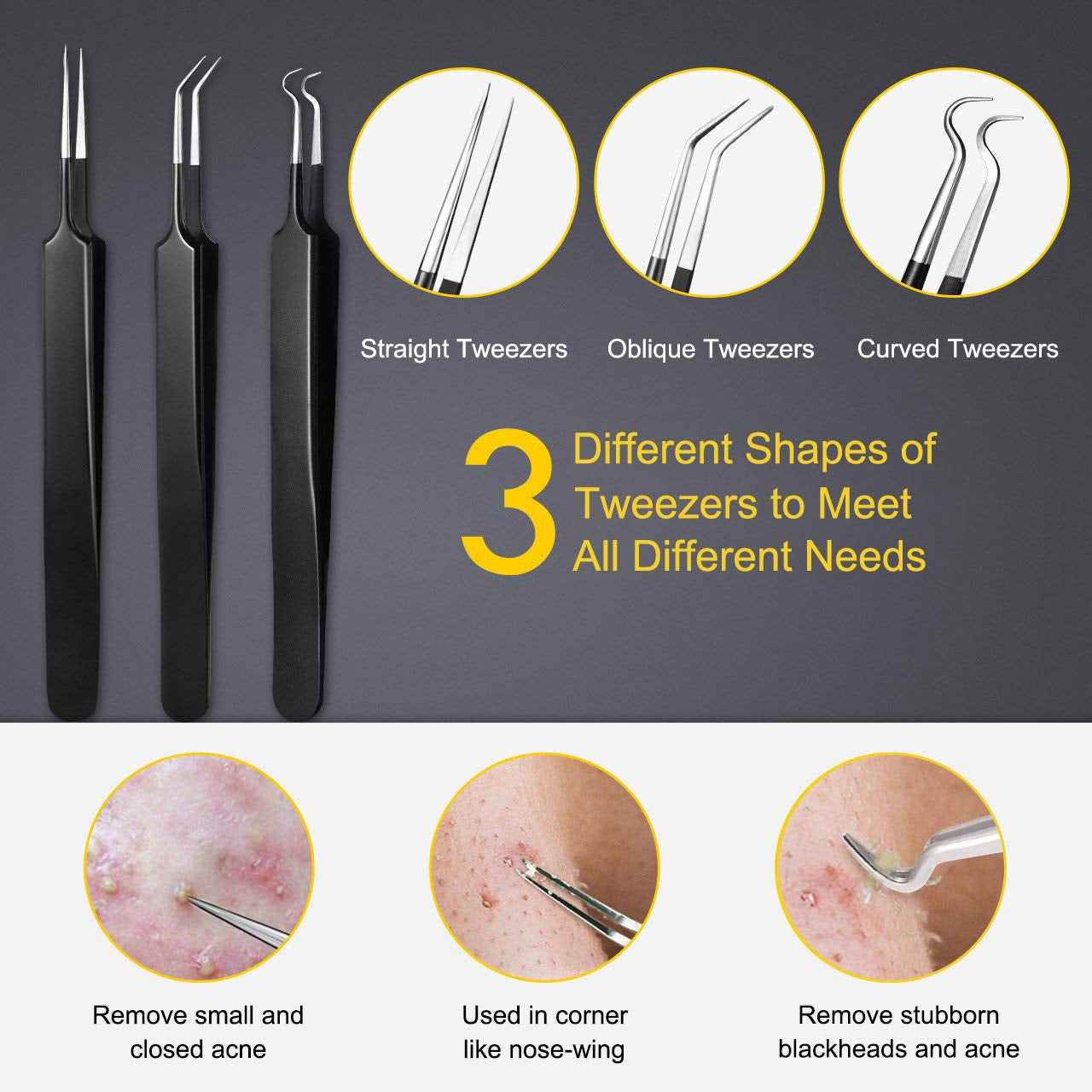 Pimple Popper Tool Kit - Boxoyx 10 Pcs Blackhead Remover Comedone Extractor Kit with Metal Case for Quick and Easy Removal of Pimples, Blackheads, Zit Removing, Forehead,Facial and Nose（Black) Health & Beauty > Personal Care > Cosmetics > Cosmetic Tools > Skin Care Tools Boxoyx   