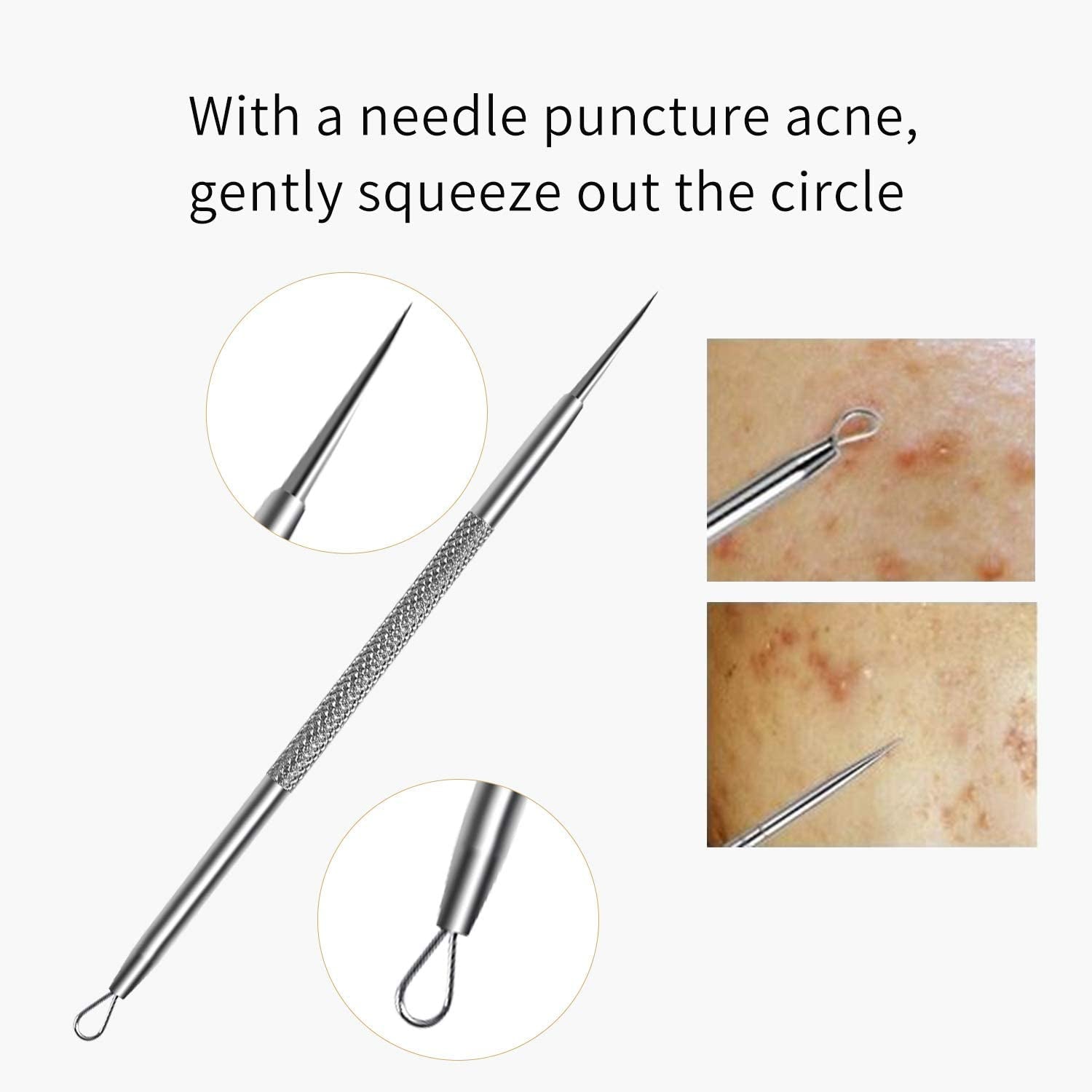 FIXBODY Blackhead and Splinter Remover Tools - Stainless Steel Professional Easily Cure Pimples Whiteheads Comedones Acne Zit Ingrown Hairs and Facial Impurities Bend Head Tweezer Surgical Kit Health & Beauty > Personal Care > Cosmetics > Cosmetic Tools > Skin Care Tools FIXBODY   
