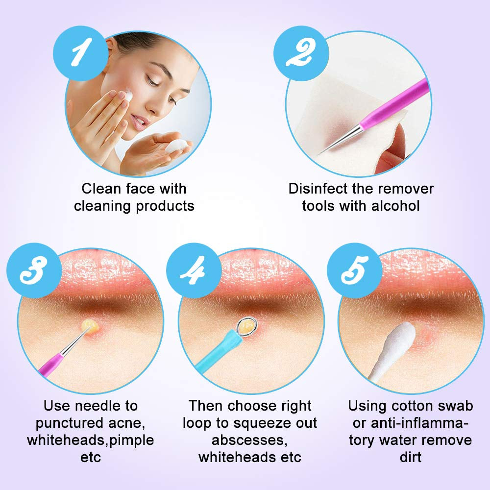 Blackhead Remover Tool Kit, Aooeou 10 Pcs Professional Pimple Popper Tool -Treatment for Pimples, Blackheads, Blemish, Zit Removing, Forehead and Nose(Colorful) Health & Beauty > Personal Care > Cosmetics > Cosmetic Tools > Skin Care Tools Aooeou   