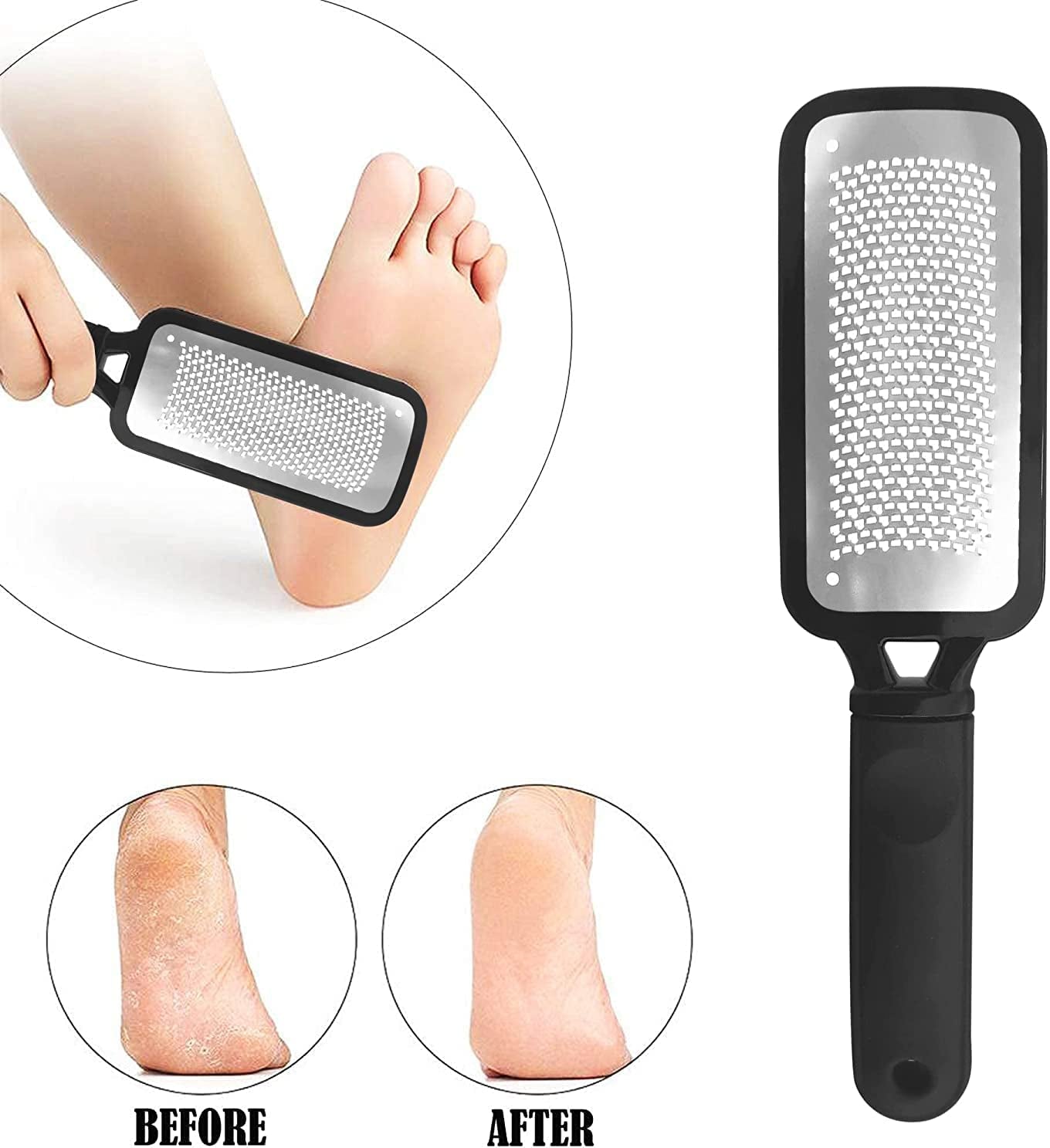 Tea Tree Foot Soak, Callus Remover Gel & Foot File Kit - Extra Strength Callus Remover Gel & Foot Soak with Epsom Salts for Calluses, Dry Cracked Heels, Toenail Fungus & Odor - Pedicure for Tired Feet Health & Beauty > Personal Care > Foot Care FOOT CURE   