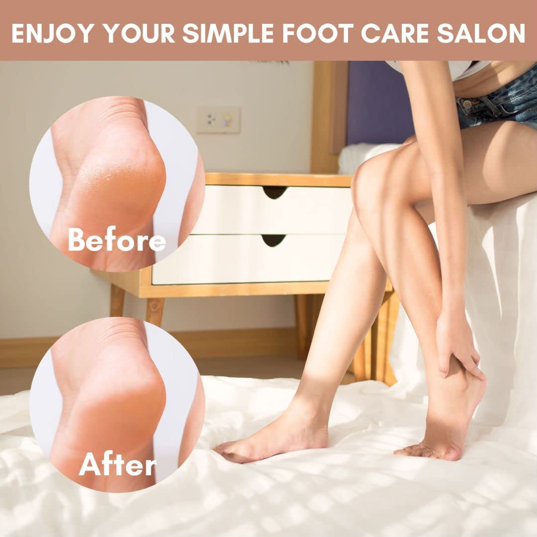Makartt Callus Remover for Feet Metal Foot Rasp File Professional Colossal Stainless Steel Foot Scrubber Dead Skin Remover Pedicure Supplies for Foot Care, Can Be Used on Both Dry and Wet Feet Health & Beauty > Personal Care > Foot Care Makartt   