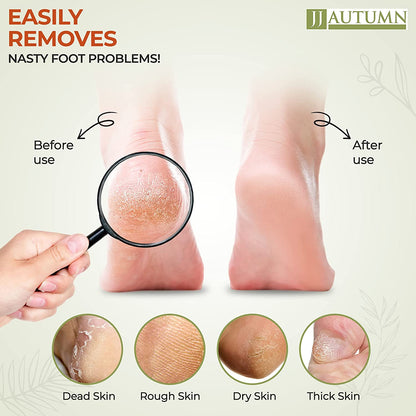JJ Autumn Professional Pedicure Foot File Callus Remover with Double Sided Foot Scrubber for Dry and Wet Feet | Coarse & Fine Two-Sided Scraper | Foot Scraper for Dead Skin | Spa Quality Foot Filer Feet Rasp | Gentle & Friendly Foot File Health & Beauty > Personal Care > Foot Care JJ Autumn   