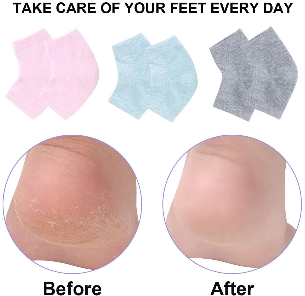 Vented Moisturizing Gel Heel Socks, 3 Pairs Toeless Spa Sock for Foot Care Treatment, Cracked Heels, Dry Feet, Foot Calluses (Gray, Green, Pink) Health & Beauty > Personal Care > Foot Care Exptolii   