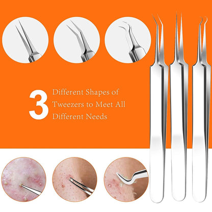 2022 Latest 15 PCS Blackhead Remover Tools, Pimple Popper Tool Kit, Acne Extractor Tool, Professional Stainless Pimple Acne Blemish Removal Tools Set with Metal Case Health & Beauty > Personal Care > Cosmetics > Cosmetic Tools > Skin Care Tools FREESHOW   