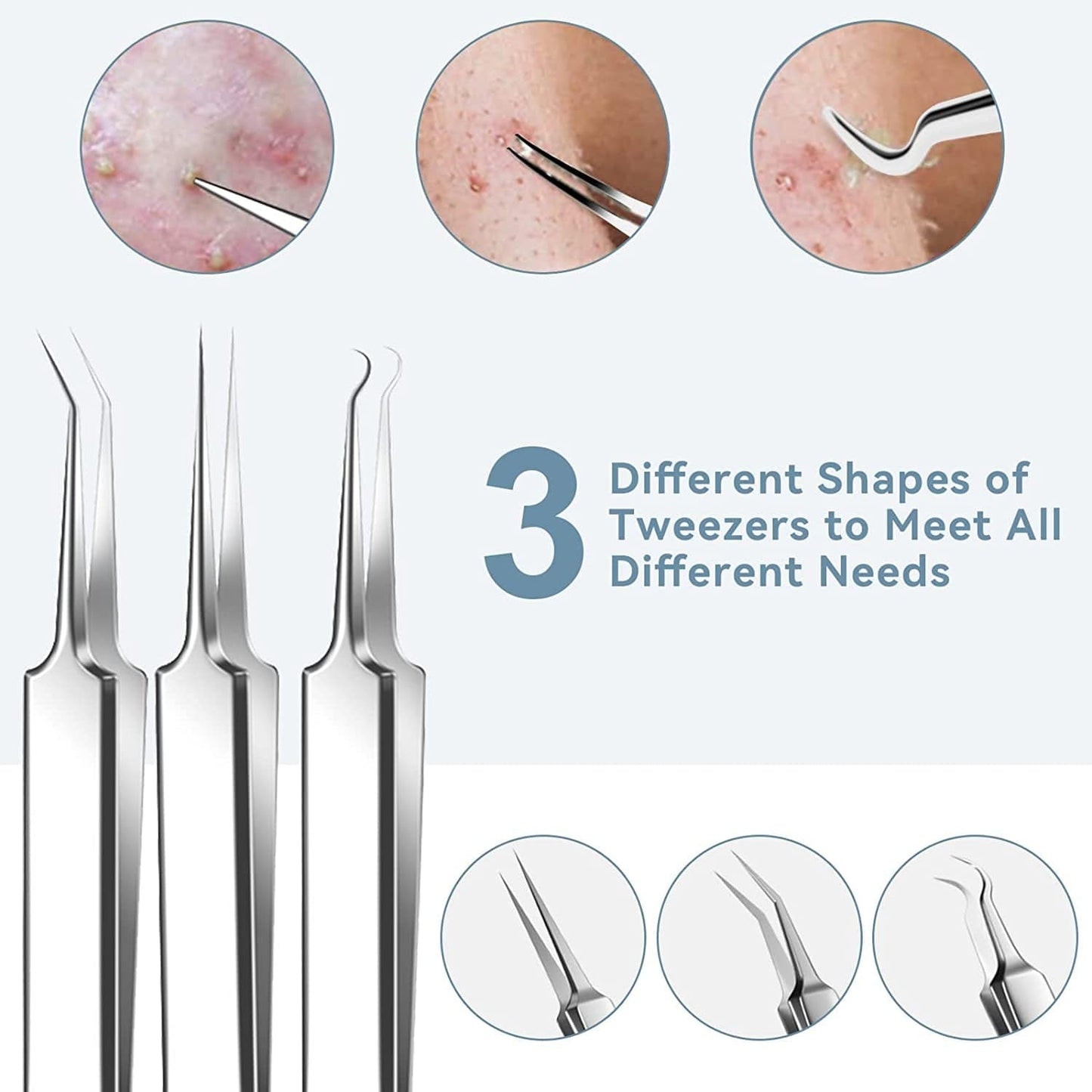 2022 Latest 15 PCS Pimple Popper Tool Kit, Blackhead Remover Comedone Acne Extractor Tools, Professional Sharp Stainless Skin Blemish Removal Pimple Tools with Metal Case Health & Beauty > Personal Care > Cosmetics > Cosmetic Tools > Skin Care Tools Feiqio   
