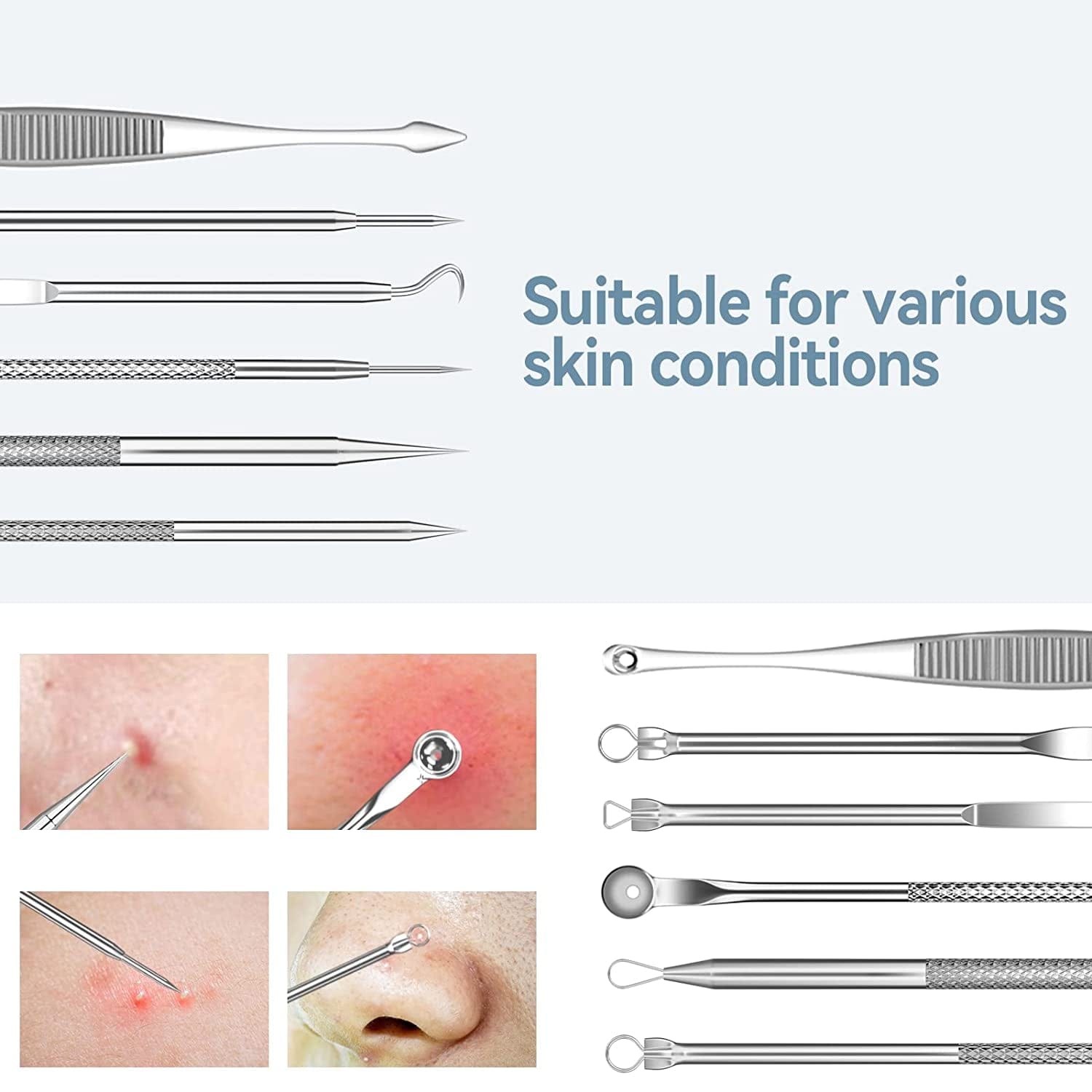 2022 Latest 15 PCS Pimple Popper Tool Kit, Blackhead Remover Comedone Acne Extractor Tools, Professional Sharp Stainless Skin Blemish Removal Pimple Tools with Metal Case Health & Beauty > Personal Care > Cosmetics > Cosmetic Tools > Skin Care Tools Feiqio   