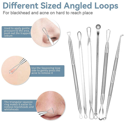 2022 Latest 15 PCS Pimple Popper Tool Kit, Blackhead Remover Comedone Acne Extractor Tools, Professional Sharp Stainless Skin Blemish Removal Pimple Tools with Metal Case Health & Beauty > Personal Care > Cosmetics > Cosmetic Tools > Skin Care Tools Feiqio   