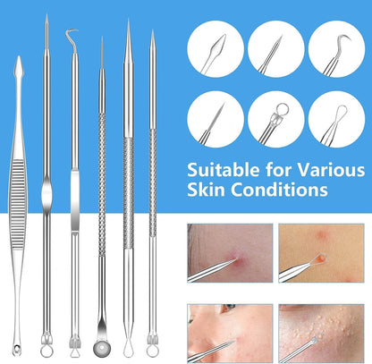 2022 Latest Blackhead Remover Pimple Popper Tool Kit, 20PCS Black Head Extractions Tool, Comedone Extractor Acne Blackhead Extractor Tool Kits Acne Removal Kit for Pimple Acne Blackhead Whitehead Health & Beauty > Personal Care > Cosmetics > Cosmetic Tools > Skin Care Tools KEEPUON   