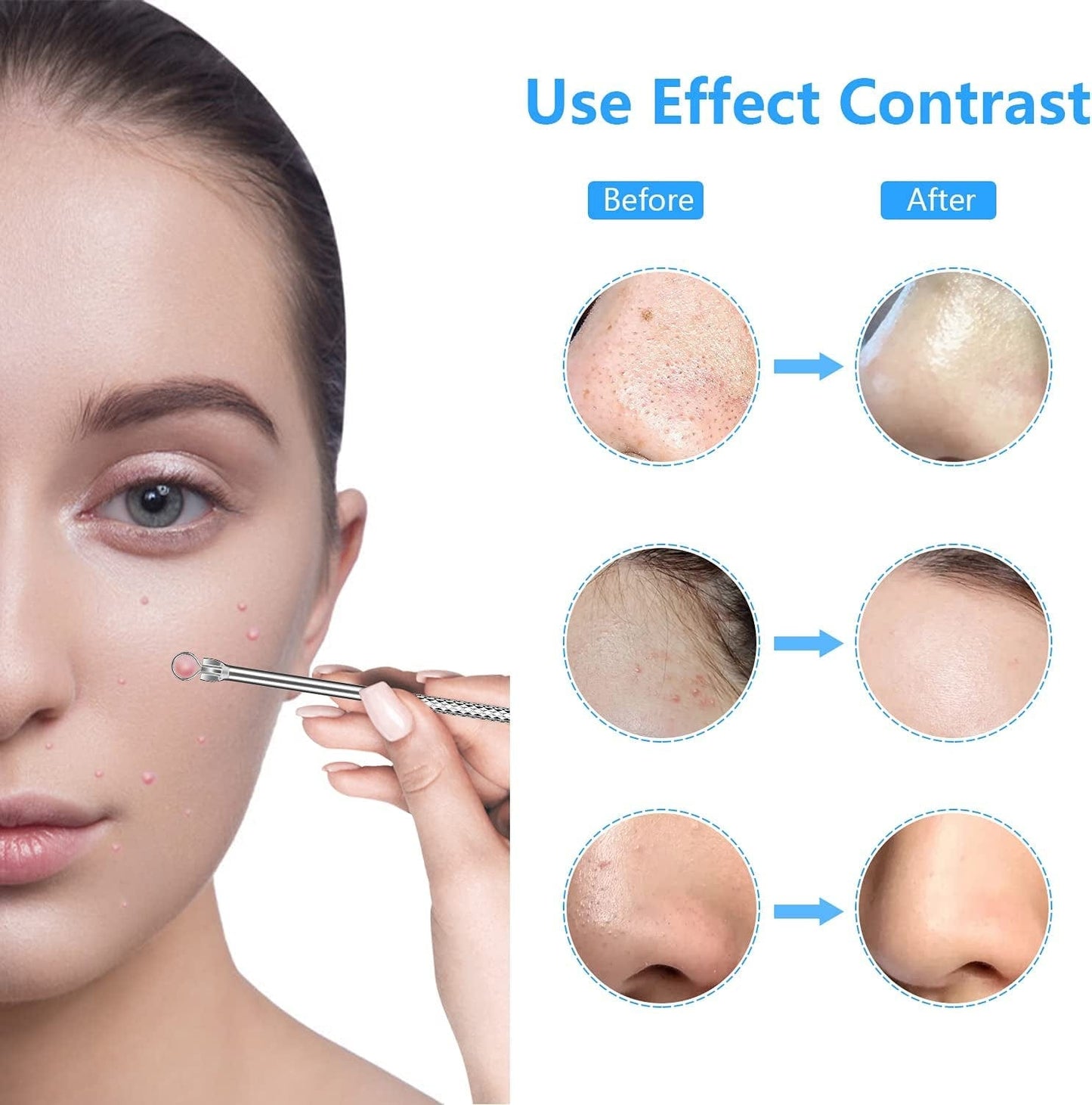 2022 Latest Blackhead Remover Pimple Popper Tool Kit, 20PCS Black Head Extractions Tool, Comedone Extractor Acne Blackhead Extractor Tool Kits Acne Removal Kit for Pimple Acne Blackhead Whitehead Health & Beauty > Personal Care > Cosmetics > Cosmetic Tools > Skin Care Tools KEEPUON   