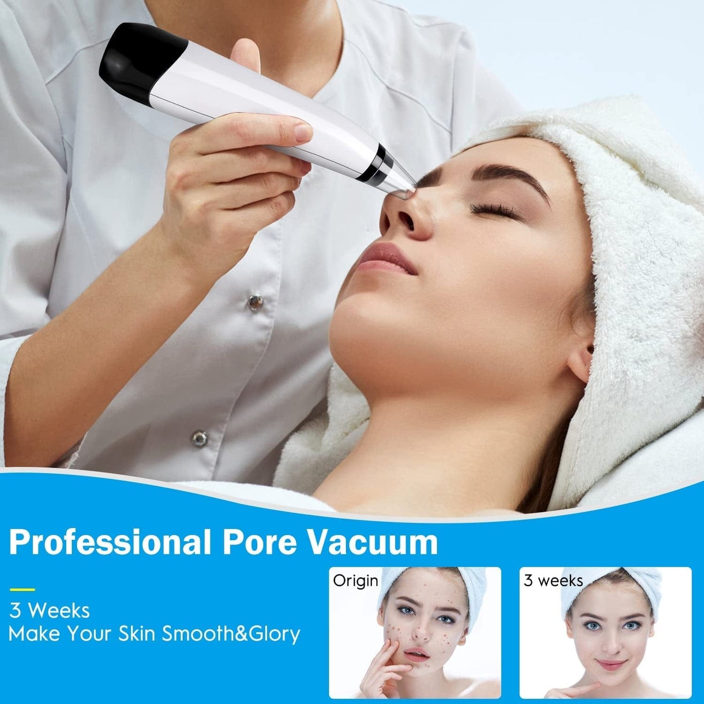 2022 New Version Blackhead Vacuum Remover Acne Remover,Facial Pore Cleanser Electric Acne Comedone, 6 Adjustable Suction Power, USB Rechargeable, Blackhead Extractor Tool Health & Beauty > Personal Care > Cosmetics > Cosmetic Tools > Skin Care Tools Musment   